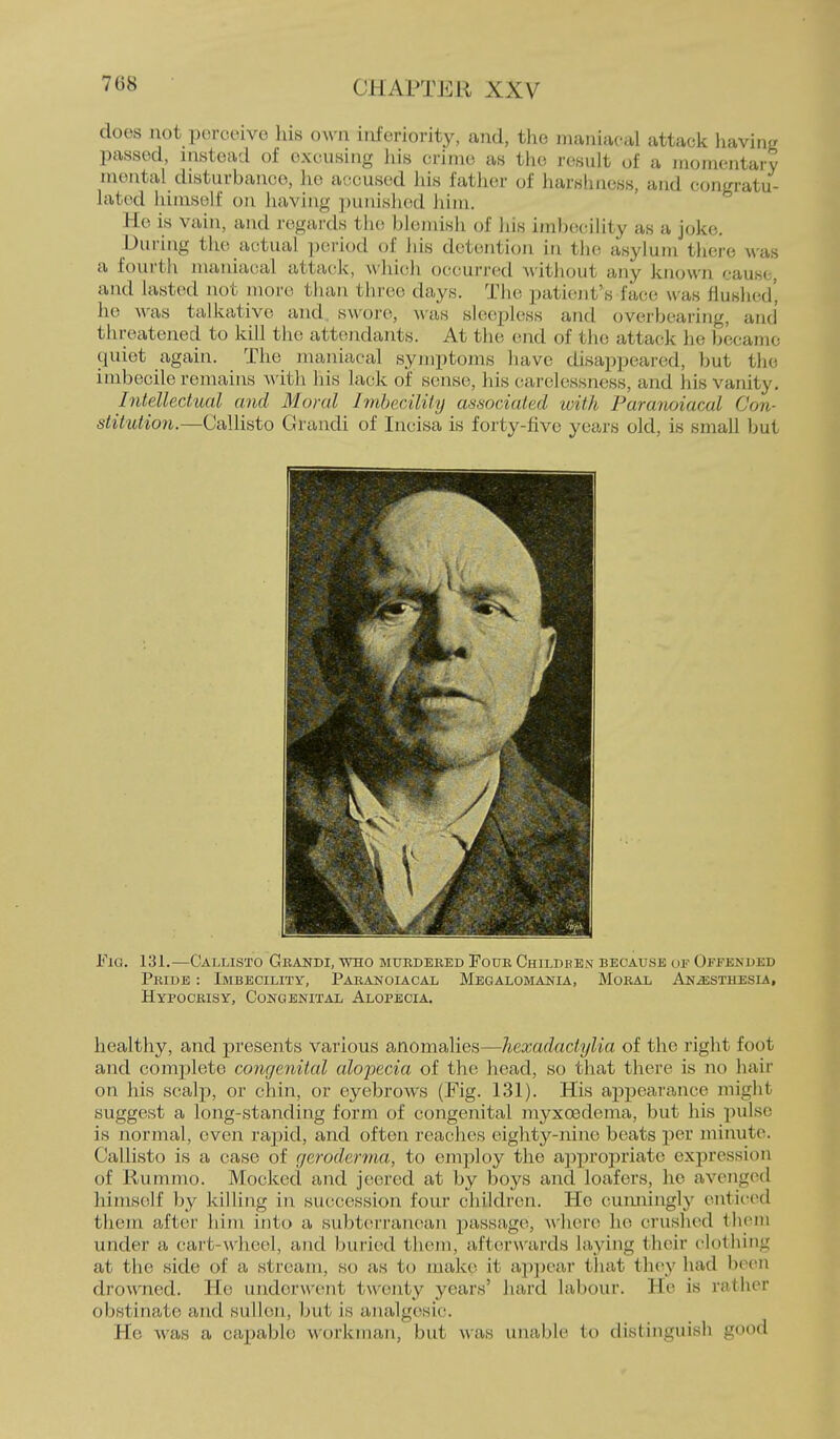 does not perceive his own inferiority, and, the maniacal attack having passed, instead of excusing liis crime as the result of a momentary mental disturbance, lie accused his father of harshness, and congratu- lated himself on having punished him. He is vain, and regards the blemish of his imbecility as a joke. -During the actual period of his detention in the asylum there was a fourth maniacal attai;k, which occurred Avithout any known cause, and lasted not more than three days. The patient's face was flushed', he M-as talkative and swore, was sleepless and overbearing, and threatened to kill the attcnidants. At the end of the attack he became quiet again. The maniacal symptoms have disappeared, but the imbecile remains ;^\'ith his lack of sense, his carelessness, and his vanity. Intellectual and Moral Imbecility associated with Pararwiacal Con- stitution.—Callisto Grandi of Incisa is forty-five years old, is small but healthy, and presents various anomalies—hexadactylia of the right foot and complete congenital alopecia of the head, so that there is no hair on his scalp, or chin, or eyebrows (Fig. 131). His appearance might suggest a long-standing form of congenital myxoedema, but his pulse is normal, even rapid, and often reaches eighty-nine beats per minute. Callisto is a case of geroderma, to employ the ajjpropriate expression of Rummo. Mocked and jeered at by boys and loafers, he avenged himself by killing in suc;ccssion four children. He cunningly enticed them after him into a subterranean passage, where he crushed them under a cart-wheel, and buried them, afterwards laying their clothing at the side of a stream, so as to make it appear that they had been drowned. He underwent twenty years' hard labour. He is riithor obstinate and sullen, but is analgesic. He was a capable workman, but was unable to distinguish good