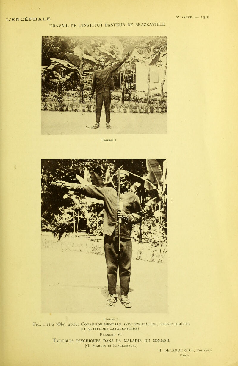 TRAVAIL DE L'INSTITUT PASTEUR DE BRAZZAVILLE 5 ANNEE. igiO KlGUBE 2 FiG. t et 2 (Obs. 422): Confusion mentale avec excitation, suGGESTiBil.itp; ET ATTITUDES CATALEPTOÏDES. Planchk VI Troubles psychiques dans la maladie du sommeil (G. Martin et Ringenbach.) H. DKI.AKUK & Ci-, l-:niTEiiRS l'ARIS.