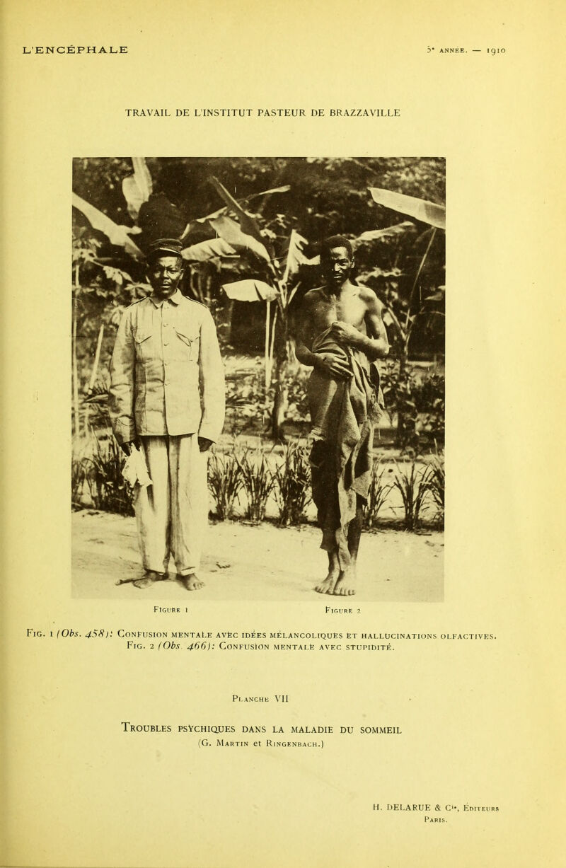 igio TRAVAIL DE L'INSTITUT PASTEUR DE BRAZZAVILLE FtGuSE t Figure 2 FiG. t (Obs. 4S8): CoNfUSION MENTALE AVÈC IDÉES MELANCOLIQUËS ËT HALLUCINATIONS OLFACTIVES. FiG. 2 (Obs 466): Confusion mentalë avec stupidité. Planche VII Troubles psychiques dans la maladie du sommeil (G. Martin et Ringenbach.) H. DEI.ARUE & Ci-, Éditeurs Paris.