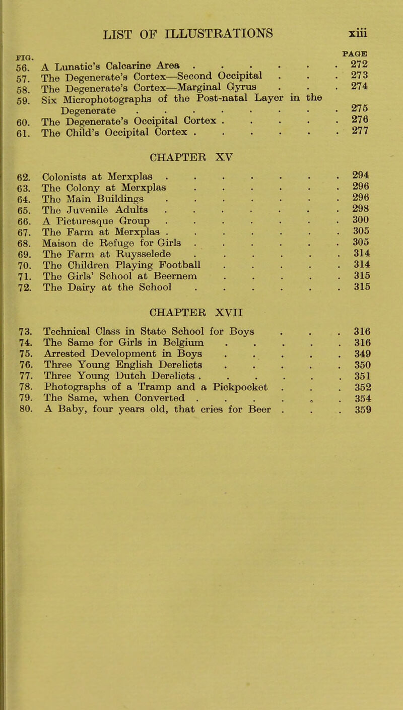 66. A Lunatic's Calcarine Area ...... 272 57. The Degenerate's Cortex—Second Occipital . . .273 5S. The Degenerate's Cortex—Marginal Gyrus . . . 274 69, Six Microphotographs of the Post-natal Layer in the Degenerate . . . • • • • .275 60. The Degenerate's Occipital Cortex 276 61. The Child's Occipital Cortex 277 CHAPTER XV 62. Colonists at Merxplas ....... 294 63. The Colony at Merxplas 296 64. The Main Buildings 296 65. The Juvenile Adults 298 66. A Picturesque Group ....... 300 67. The Farm at Merxplas 305 68. Maison de Refuge for Girls ...... 305 69. The Farm at Ruysselede . . . . . .314 70. The Children Playing Football 314 71. The Girls' School at Beernem 315 72. The Dairy at the School 315 CHAPTER XVII 73. Technical Class in State School for Boys . . .316 74. The Same for Girls in Belgium . . . . .316 75. Arrested Development in Boys ..... 349 76. Three Young English Derelicts . . . . . 350 77. Three Young Dutch Derelicts. . . . . .351 78. Photographs of a Tramp and a Pickpocket . . . 352 79. The Same, when Converted 354 80. A Baby, foiir years old, that cries for Beer . . . 359
