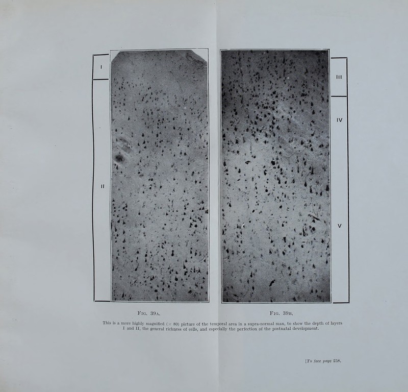 Fig. 39a, Fig. 39b, This is a more liiglily magnified (x 80) picture of the temporal area in a supra-normal man, to show the depth of layers I and II, the general richness of cells, and especially the perfection of the postnatal development.