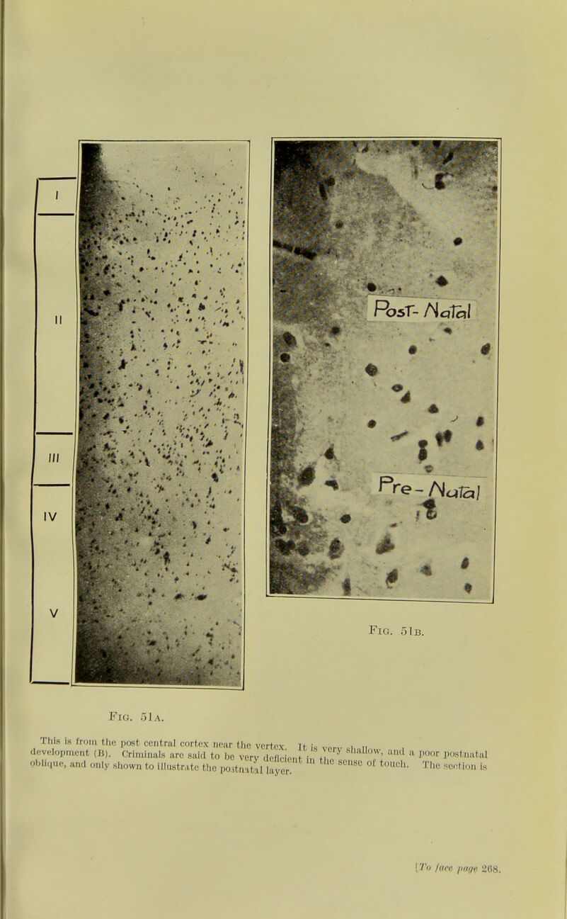 Fig. 51b. Fici. oJa. ThLs is from the post central cortex near the vertex- Tt i» > „ development (B). CriminalH are said to be very deftdor.t i f h ^ J'' l«ta(al pbUque. and only shown to illustrate the poitnatJl layer '^''^ ^^'^•'>' !'/'() face lum 268.