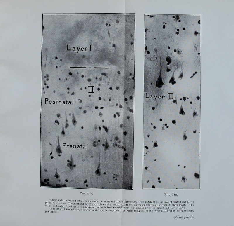 Layer I « ♦ 9^ '•n • Postnatal ^ 1% Prenatal ♦ • Fig. 54a. • 4 / Layer X # Fig. 54b. psychic fuiictionr Tt '^^'S from the prefrontal of tlie degenerate. It is regarded as the seat of control and higher is the most undevH l 'l'*'^' development is much arrested, and there is a preponderance of neuroblasts througliout. This B is situated r'!- '^'^'^ ^^''''^ cortex, as, indeed, we niiglit expect, considering it is the higliest and last to evolve. 400 time.s) n'neaiately below A, and thus tliey represent the whole thickness of the pyramidal layer (multipUed nearly