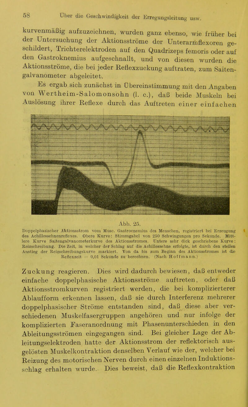 kurvenraäßig aufzuzeichnen, wurden ganz ebenso, wie früher bei der Untersuchung der Aktionsströme der Unterarmflexoren ge- schildert, Trichterelektroden auf den Quadrizeps femoris oder auf den Gastroknemius aufgeschnallt, und von diesen wurden die Aktionsströme, die bei jeder Reflexzuckung auftraten, zum Saiten- galvanometer abgeleitet. Es ergab sich zunächst in Übereinstimmung mit den Angaben von Wertheim-Salomonsohn (1. c), daß beide Muskeln bei Auslösung ihrer Reflexe durch das Auftreten einer einfachen ■ - ' - '■ h- - - -  ^ - t- ■ Abb. 25. Doppelphasischer Aktionsstrom vom Muse. Gastrocnemius des Meuschen, registriert bei Erzeugimg » des Acliillessehnenreflexes. Obere Kurve: Stimmgabel von 250 Schwingungen pro Seliunde. Mitt- lere Kurve Saitengalvanometerkurve des Aktionsstromes. Untere sehr dick geschriebene Kurve: Reizschreibung. Die Zeit, in welcher der Schlag auf die Achillessehne erfolgte, ist durch den steilen Anstieg der Reizschreibungskurve markiert. Von da bis zum Beginn des Aktionsstromes ist die Reflexzeit -— 0,01 Sekunde zu berechnen. (Nach Hoffmann.) Zuckung reagieren. Dies wird dadurch bewiesen, daß entweder einfache doppelphasische Aktionsströme auftreten, oder daß Aktionsstromkurven registriert werden, die bei komplizierterer Ablaufform erkennen lassen, daß sie durch Interferenz mehrerer doppelphasischer Ströme entstanden sind, daß diese aber ver- schiedenen Muskelfasergruppen angehören und nur infolge der komplizierten Faseranordnung mit Phasenunterschieden in den Ableitungsströmen eingegangen sind. Bei gleicher Lage der Ab- leitungselektroden hatte der Aktionsstrom der reflektorisch aus- gelösten Muskelkontraktion denselben Verlauf wie der, welcher bei Reizung des motorischen Nerven durch einen einzelnen Induktions- schlag erhalten wurde. Dies beweist, daß die Reflexkontraktion