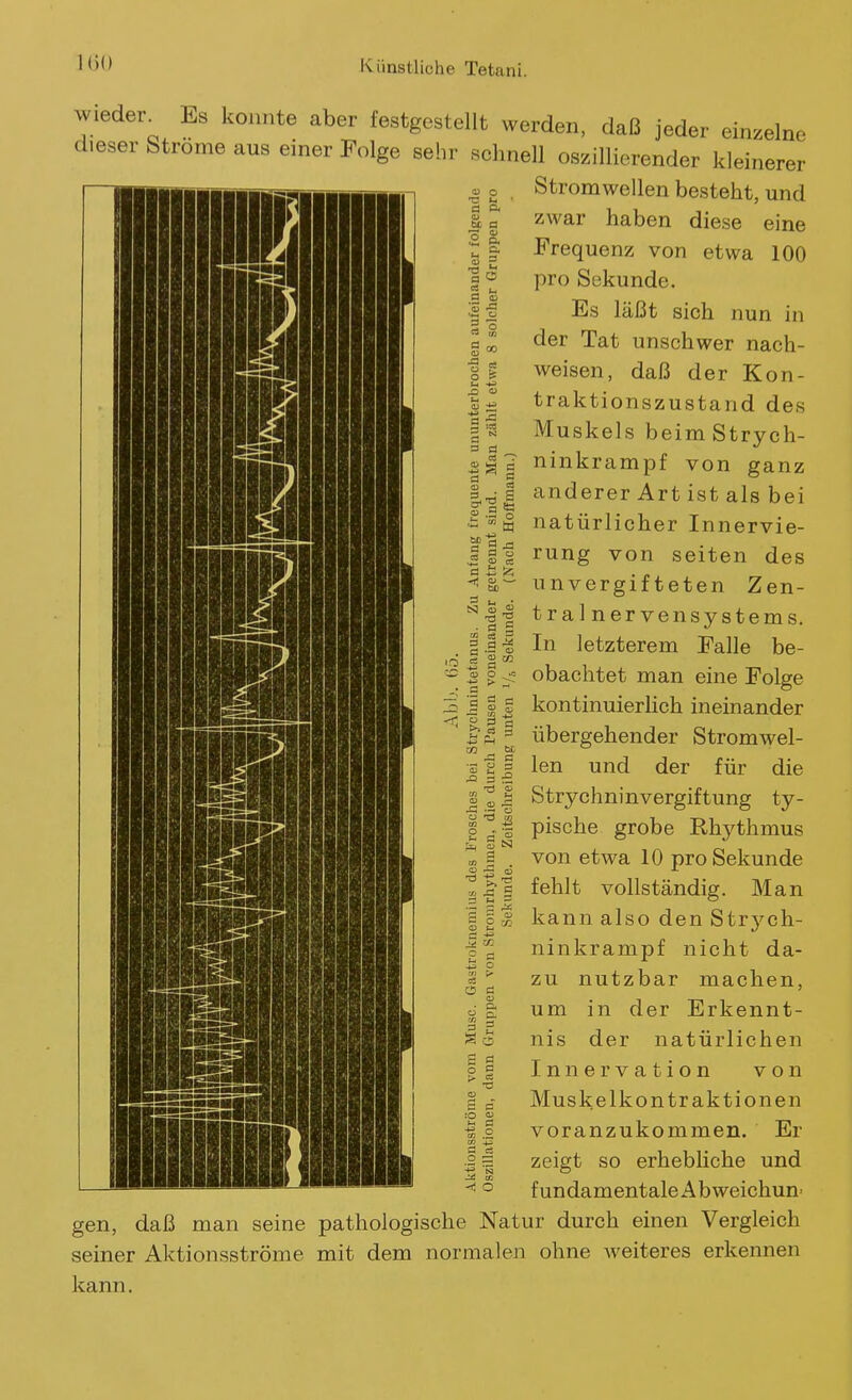 100 o o et P< o 6c a !l « I-, o C3 Ol Ö 00 o o a Wieder^ Es konnte aber festgestellt werden, daß jeder einzelne dieser Strome aus einer Folge sehr schnell oszillierender kleinerer Strom wellen besteht, und zwar haben diese eine Frequenz von etwa 100 pro Sekunde. Es läßt sich nun in der Tat unschwer nach- weisen, daß der Kon- traktionszustand des Muskels beimStrych- ninkrampf von ganz anderer Art ist als bei natürlicher Innervie- rung von Seiten des unvergif teten Zen- tralnervensystems. In letzterem Falle be- obachtet man eine Folge kontinuierlich ineinander übergehender Stromwel- len und der für die Strychninvergiftung ty- pische grobe Rhythmus von etwa 10 pro Sekunde fehlt vollständig. Man kann also den Strych- ninkrampf nicht da- zu nutzbar machen, um in der Erkennt- nis der natürlichen Innervation von Muskelkontraktionen voranzukommen. Er zeigt so erhebliche und fundamentale Abweichun gen, daß man seine pathologische Natur durch einen Vergleich seiner Aktionsströme mit dem normalen ohne weiteres erkennen kann. C3 =^ n « 2 ■= o  tu Iis ' 60 ■ a 2 =s c a o S CO cp O S m S e ^ fl - s 'S tJ 3 J2 3 5 S CD Ä 'l3 -r .3 C5 d D. 3 3 O cä S CS -< o