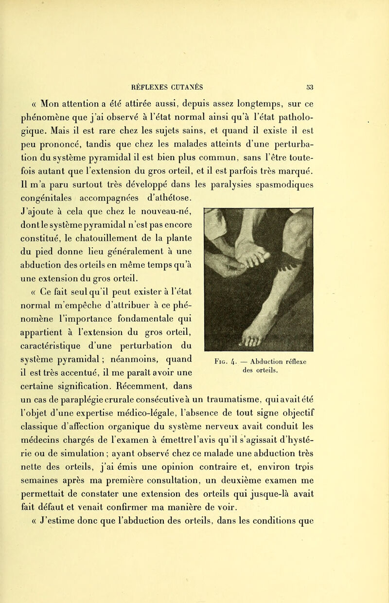 (( Mon attention a été attirée aussi, depuis assez longtemps, sur ce phénomène que j'ai observé à l'état normal ainsi qu'à l'état patholo- gique. Mais il est rare chez les sujets sains, et quand il existe il est peu prononcé, tandis que chez les malades atteints d'une perturba- tion du système pyramidal il est bien plus commun, sans l'être toute- fois autant que l'extension du gros orteil, et il est parfois très marqué. 11 m'a paru surtout très développé dans les paralysies spasmodiques congénitales accompagnées d'athétose. J'ajoute à cela que chez le nouveau-né, dont le système pyramidal n'est pas encore constitué, le chatouillement de la plante du pied donne lieu généralement à une abduction des orteils en même temps qu'à une extension du gros orteil. « Ce fait seul qu il peut exister à l'état normal m'empêche d'attribuer à ce phé- nomène l'importance fondamentale qui appartient à l'extension du gros orteil, caractéristique d'une perturbation du système pyramidal ; néanmoins, quand pic. k- — Abduction réflexe il est très accentué, il me paraît avoir une orteils, certaine signification. Récemment, dans un cas de paraplégie crurale consécutive à un traumatisme, qui avait été l'objet d'une expertise médico-légale, l'absence de tout signe objectif classique d'affection organique du système nerveux avait conduit les médecins chargés de l'examen à émettre l'avis qu'il s'agissait d'hysté- rie ou de simulation ; ayant observé chez ce malade une abduction très nette des orteils, j'ai émis une opinion contraire et, environ trpis semaines après ma première consultation, un deuxième examen me permettait de constater une extension des orteils qui jusque-là avait fait défaut et venait confirmer ma manière de voir. « J'estime donc que l'abduction des orteils, dans les conditions que