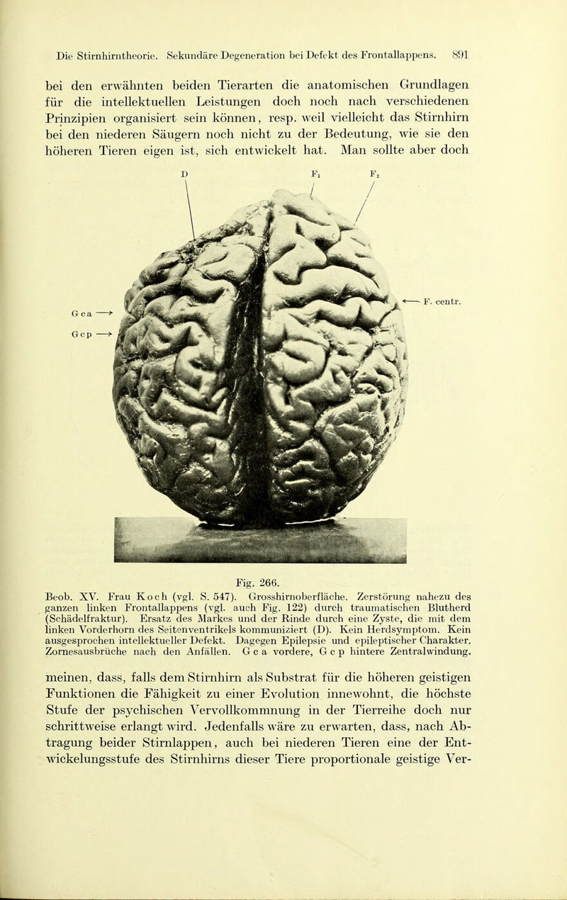 bei den erwähnten beiden Tierarten die anatomischen Grundlagen für die intellektuellen Leistungen doch noch nach verschiedenen Prinzipien organisiert sein können, resp. weil vielleicht das Stirnhirn bei den niederen Säugern noch nicht zu der Bedeutung, wie sie den höheren Tieren eigen ist, sich entwickelt hat. Man sollte aber doch D Fl Fa F. centr. Fig. 266. Beob. XV. Frau Koch (vgl. S. 547). Grosshirnoberfläche. Zerstörung nahezu des ganzen linken Frontallappens (vgl. auch Fig. 122) durch traumatischen Blutherd (Schädelfraktur). Ersatz des Markes und der Rinde durch eine Zyste, die mit dem linken Vorderhorn des Seitenventrikels kommuniziert (D). Kein Herdsymptom. Kein ausgesprochen intellektueller Defekt. Dagegen Epilepsie imd epileptischer Charakter. Zornesausbriiche nach den Anfällen. G c a vordere, G c p hintere Zentralwindung. meinen, dass, falls dem Stirnhirn als Substrat für die höheren geistigen Funktionen die Fähigkeit zu einer Evolution innewohnt, die höchste Stufe der psychischen Vervollkommnung in der Tierreihe doch nur schrittweise erlangt wird. Jedenfalls wäre zu erwarten, dass, nach Ab- tragung beider Stirnlappen, auch bei niederen Tieren eine der Ent- wickelungsstufe des Stirnhirns dieser Tiere proportionale geistige Ver-