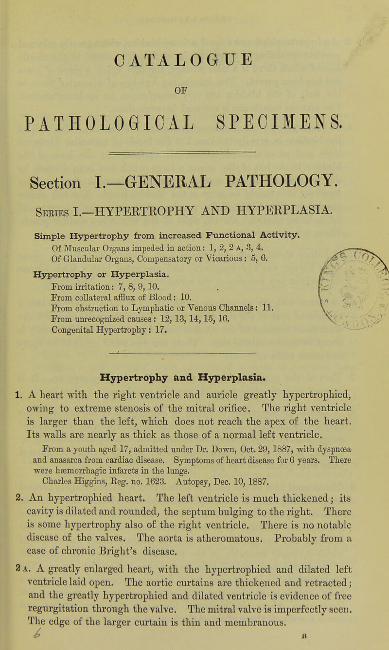 CATALOGUE OF PATHOLOGICAL SPECIMENS. Section I.—GENERAL PATHOLOGY. Sewes I.—hypertrophy AND HYPERPLASIA. Simple H3^ertrophy from increased Functional Activity. Of Muscular Organs impeded in action: 1, 2, 2 a, 3, 4. Of Glandular Organs, Compensatory or Vicarious: 5, 6. Hypertrophy or H37perplasia. From irritation: 7, 8, 9,10. From collateral afflux of Blood: 10. From obstruction to Lymphatic or Venous Channels: 11, From unrecognized causes : 12,13, 14,16, 16. Congenital Hypertrophy: 17. Hypertrophy and Hyperplasia. 1. A heart with the right ventricle and auricle greatly hypertrophied, owing to extreme stenosis of the mitral orifice. The right ventricle is larger than the left, which does not reach the apex of the heart. Its walls are nearly as thick as those of a normal left ventricle. From a youth aged 17, admitted under Dr. Down, Oct. 29, 1887, with dyspnoea and anasarca from cardiac disease. Symptoms of heart disease for 6 years. There were hsemorrhagic infarcts in the lungs. Charles Higgins, Reg. no. 1623, Autopsy, Dec. 10, 1887. 2. An hypertrophied heart. The left ventricle is much thickened; its cavity is dilated and rounded, the septum bulging to the right. There is some hypertrophy also of the right ventricle. There is no notable disease of the valves. The aorta is atheromatous. Probably from a case of chronic Bright^s disease. 2 A. A greatly enlarged heart, with the hypertrophied and dilated left ventricle laid open. The aortic curtains are thickened and retracted; and the greatly hypertrophied and dilated ventricle is evidence of free regurgitation through the valve. The mitral valve is imperfectly seen. The edge of the larger curtain is thin and membranous.