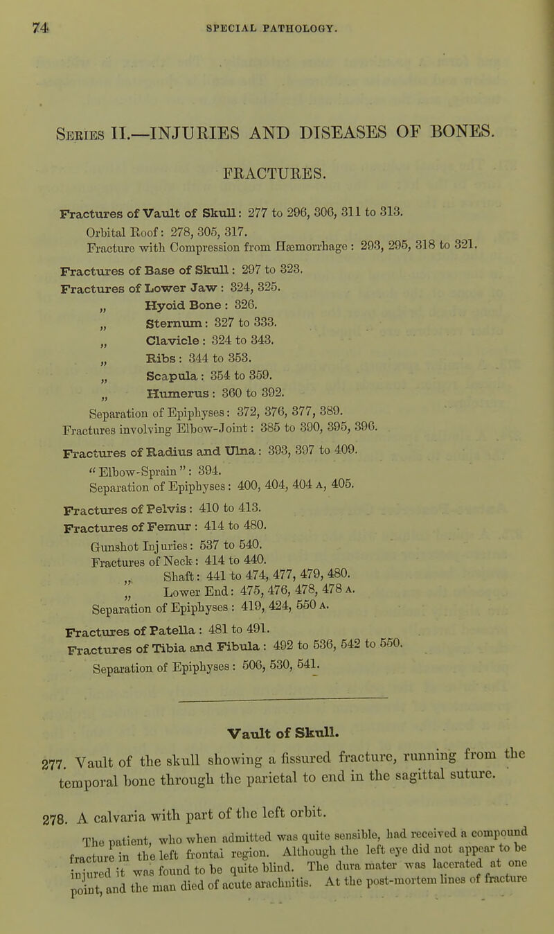 Series II.—INJURIES AND DISEASES OF BONES. FRACTURES. Fractures of Vault of SkuU: 277 to 296, 306, 311 to 313. Orbital Roof: 278, 305, 317. Fracture with Compression from Hsemorrhage: 293, 295, 318 to 321. Fractures of Base of Skull: 297 to 323. Fractures of Lower Jaw : 324, 325. „ HyoidBone: 326. „ Sternum: 327 to 333. „ Clavicle : 324 to 343. Kibs : 344 to 353. „ Scapula: 354 to 359. „ Humerus : 360 to 392. Separation of Epiphyses: 372, 376, 377, 389. Fractures involving Elbow-Joint: 385 to 390, 395, 396. Fractvires of Radius and Ulna: 393, 397 to 409. Elbow-Sprain: 394. Separation of Epiphyses: 400, 404, 404 a, 405. Fractures of Pelvis : 410 to 413. Fractures of Femur : 414 to 480. Gunshot Injuries: 537 to 540. Fractures of Neck: 414 to 440. „ Shaft: 441 to 474, 477, 479, 480. Lower End: 475, 476, 478, 478 a. Separation of Epiphyses : 419, 424, 550 a. Fractures of Patella : 481 to 491. Fractures of Tibia and Fibula : 492 to 536, 542 to 550. Separation of Epiphyses : 506, 530, 541. Vault of Skull. 277 Vault of the skull showing a fissured fracture, runniug from the temporal bone through the parietal to end in the sagittal suture. 278. A calvaria with part of the left orbit. The patient, who when admitted was quite sensible, had received a compound fracture in the left frontal region. Although the left eye did not PP^ar to be niured it was found to be quite blind. The dura mater was lacerated at one pXt and the man died of acute arachnitis. At the post-mortem hnes of fracture