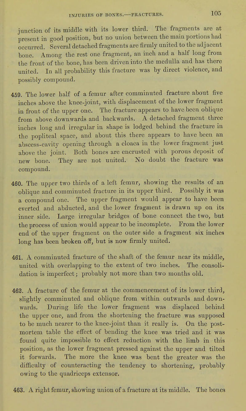 junction of its middle with its lower third. The fragments are at present in good position, but no union between the main portions had occurred. Several detached fragments are fii-mly united to the adjacent bone. Among the rest one fragment, an inch and a half long from the front of the bone, has been driven into the medulla and has there united. In all probability this fracture was by direct violence, and possibly compound. 459. The lower half of a femur after comminuted fracture about five inches above the knee-joint, witli displacement of the lower fragment in front of the upper one. The fracture appears to have been oblique from above downwards and backwards. A detached fragment three inches long and irregular in shape is lodged behind the fracture in the popliteal space, and about this there appears to have been an abscess-cavity opening through a cloaca in the lower fragment just above the joint. Both bones are encrusted with porous deposit of new bone. They are not united. No doubt the fracture was compound. 460. The upper two thirds of a left femur, showing the results of an oblique and comminuted fracture in its upper third. Possibly it was a compound one. The upper fragment would appear to have been everted and abducted, and the lower fragment is drawn up on its inner side. Large irregular bridges of bone connect the two, but the process of union would appear to be incomplete. From the lower end of the upper fragment on the outer side a fragment six inches long has been broken off, but is now firmly united. 461. A comminuted fracture of the shaft of the femur near its middle, united with overlapping to the extent of two inches. The consoli- dation is imperfect; probably not more than two months old. 462. A fracture of the femur at the commencement of its lower third, slightly comminuted and oblique from within outwards and down- wards. During life the lower fragment was displaced behind the upper one, and from the shortening the fracture was supposed to be much nearer to the knee-joint than it really is. On the post- mortem table the effect of bending the knee was tried and it was found quite impossible to efiect reduction with the limb in this position, as the lower fragment pressed against the upper and tilted it forwards. The more the knee was bent the greater was the difficulty of counteracting the tendency to shortening, probably owing to the quadriceps extensor. 463. A right femur, showing union of a fracture at its middle. The bones