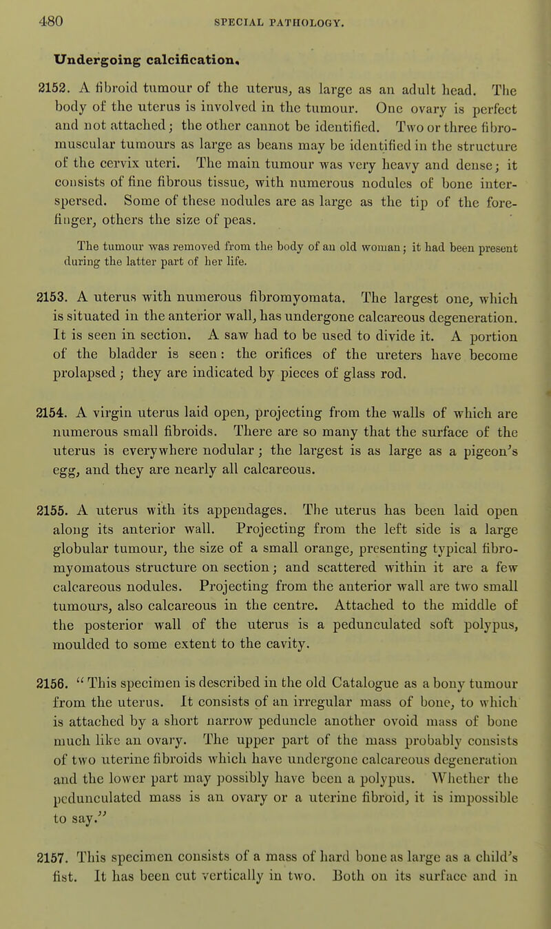 Undergoing calcification, 2152. A fibroid tumour of the uterus^ as large as an adult head. The body of the uterus is involved in the tumour. One ovary is perfect and not attached; the other cannot be identified. Two or three fibro- rauscular tumours as large as beans may be identified in the structure of the cervix uteri. The main tumour was very heavy and dense; it consists of fine fibrous tissue, with numerous nodules of bone inter- spersed. Some of these nodules are as large as the tip of the fore- finger, others the size of peas. Tlie tumour was removed from the body of an old woman; it had been present during the latter part of her life. 2153. A uterus with numerous fibromyomata. The largest one, which is situated in the anterior wall, has undergone calcareous degeneration. It is seen in section. A saw had to be used to divide it. A portion of the bladder is seen : the orifices of the ureters have become prolapsed; they are indicated by pieces of glass rod. 2154. A virgin uterus laid open, projecting from the walls of which are numerous small fibroids. There are so many that the surface of the uterus is everywhere nodular; the lai'gest is as large as a pigeon^s egg, and they are nearly all calcareous. 2155. A uterus with its appendages. The uterus has been laid open along its anterior wall. Projecting from the left side is a large globular tumour, the size of a small orange, presenting typical tibro- myomatous structure on section; and scattered within it are a few calcareous nodules. Projecting from the anterior wall are two small tumours, also calcareous in the centre. Attached to the middle of the posterior wall of the uterus is a pedunculated soft polypus, moulded to some extent to the cavity. 2156.  This specimen is described in the old Catalogue as a bony tumour from the uterus. It consists of an irregular mass of bone, to which is attached by a short narrow peduncle another ovoid mass of bone much like an ovary. The upper part of the mass probably consists of two uterine fibroids which have undergone calcareous degeneration and the lower part may possibly have been a polypus. Whether the pedunculated mass is an ovary or a uterine fibroid, it is impossible to say.^^ 2157. This specimen consists of a mass of hard bone as large as a child's fist. It has been cut vertically in two. Both on its surface and in