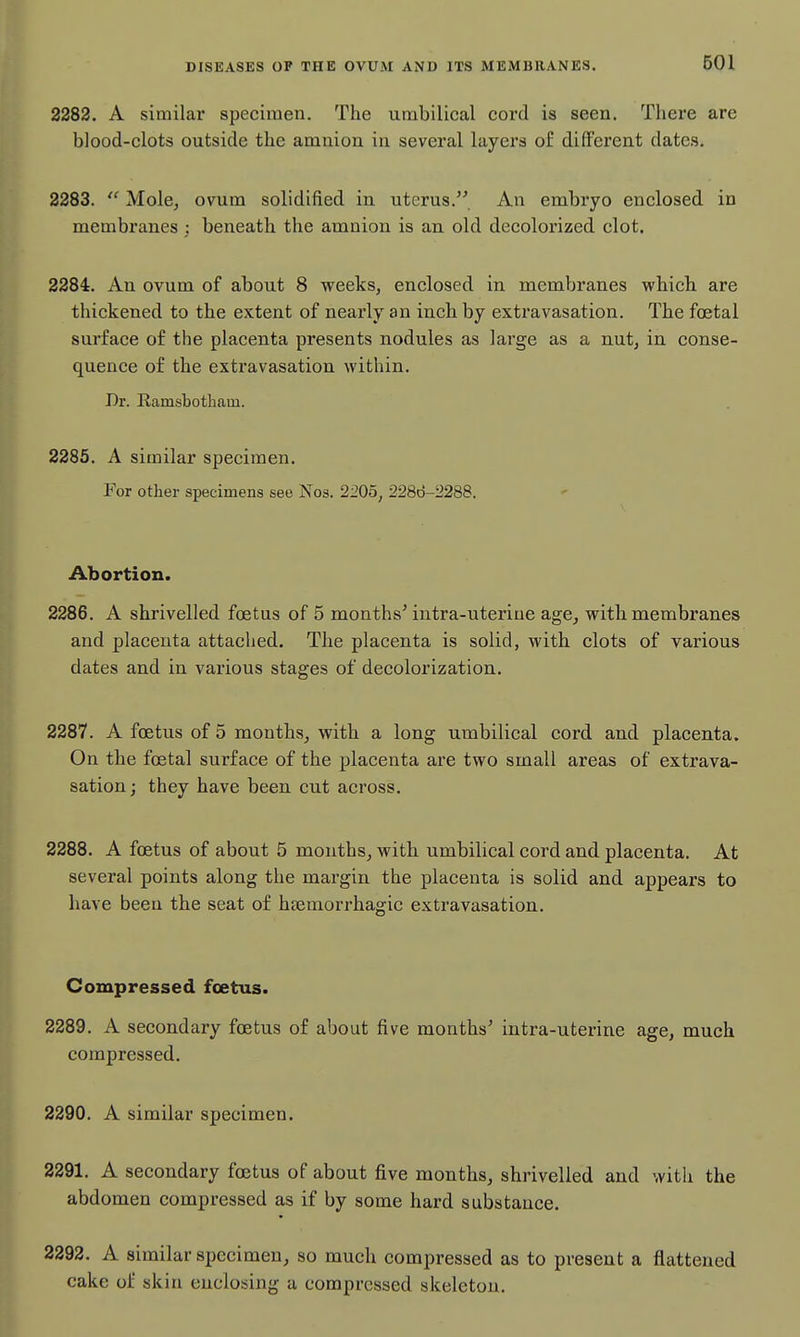 2282. A similar specimen. The umbilical cord is seen. There are blood-clots outside the amnion in several layers of different dates. 2283.  Mole, ovum solidified in uterus. An embryo enclosed in membranes; beneath the amnion is an old decolorized clot. 2284. An ovum of about 8 weeks, enclosed in membranes which are thickened to the extent of nearly an inch by extravasation. The foetal surface of the placenta presents nodules as large as a nut, in conse- quence of the extravasation within. Dr. Ramsbotham. 2285. A similar specimen. For other specimens see Nos. 2205, 2286-2288. Abortion. 2286. A shrivelled foetus of 5 months' intra-uterine age, with membranes and placenta attached. The placenta is solid, with clots of various dates and in various stages of decolorization. 2287. A foetus of 5 months, with a long umbilical cord and placenta. On the foetal surface of the placenta are two small areas of extrava- sation; they have been cut across. 2288. A foetus of about 5 months, with umbilical cord and placenta. At several points along the margin the placenta is solid and appears to have been the seat of heemorrhagic extravasation. Compressed foetus. 2289. A secondary foetus of about five months' intra-uterine age, much compressed. 2290. A similar specimen. 2291. A secondary foetus of about five months, shrivelled and with the abdomen compressed as if by some hard substance. 2292. A similar specimen, so much compressed as to present a flattened cake of skin enclosing a compressed skeleton.