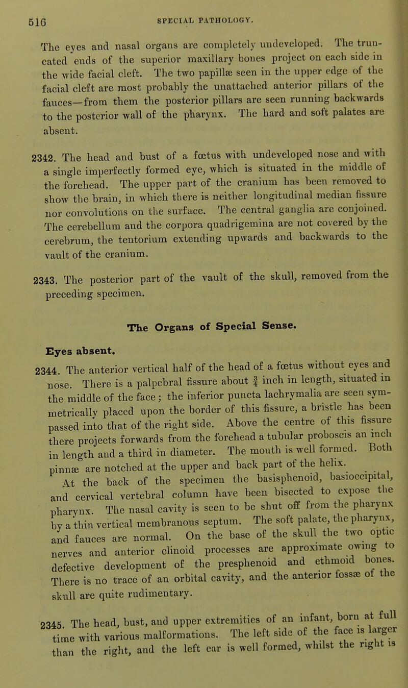 51G The eyes and nasal organs are completely undeveloped. The trun- cated ends of the superior maxillary bones project on each side in the wide facial cleft. The two papillae seen in the upper edge of the facial cleft are most probably the unattached anterior pillars of the fauces—from them the posterior pillars are seen running backwards to the posterior wall of the pharynx. The hard and soft palates are absent. 2342. The head and bust of a foetus with undeveloped nose and with a single imperfectly formed eye, which is situated in the middle of the forehead. The upper part of the cranium has been removed to show the brain, in which there is neither longitudinal median fissure nor convolutions on the surface. The central ganglia are conjoined. The cerebellum and the corpora quadrigemina are not covered by the cerebrum, the tentorium extending upwards and backwards to the vault of the cranium. 2343. The posterior part of the vault of the skull, removed from the preceding specimen. The Organs of Special Sense. Eyes absent. 2344 The anterior vertical half of the head of a foetus without eyes and nose. There is a palpebral fissure about | inch in length, situated m the middle of the face; the inferior puncta lachrymalia are seen sym- metrically placed upon the border of this fissure, a bristle has been passed into that of the right side. Above the centre of this fissure there projects forwards from the forehead a tubular proboscis an inch in length and a third in diameter. The mouth is well formed. Both pinn^ are notched at the upper and back part of the helix. At the back of the specimen the basisphenoid, basioccipital, and cervical vertebral column have been bisected to expose the pharynx. The nasal cavity is seen to be shut ofE from the pharynx by a thin vertical membranous septum. The soft palate, the pharynx, and fauces are normal. On the base of the skull the two optic nerves and anterior clinoid processes are approximate owing to defective development of the presphenoid and ethmoid bones. There is no trace of an orbital cavity, and the anterior fossae of the skull are quite rudimentary. 2345 The head, bust, and upper extremities of an infant, born at full time with various malformations. The left side of the face is lai^er than the right, and the left ear is well formed, whilst the right is