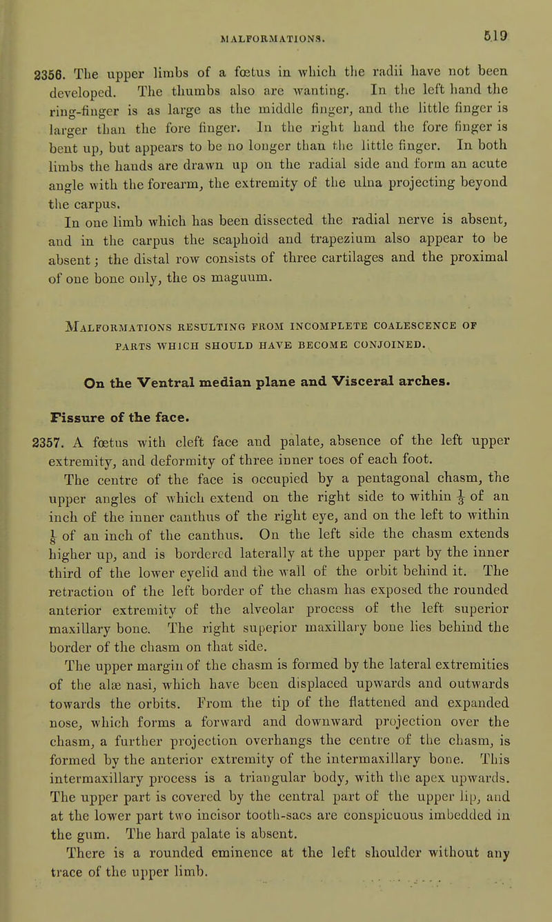 6.19 2356. The upper limbs of a foetus in wliicli tlie radii liave not been developed. The thumbs also are wanting. In tlie left hand the ring-fiuger is as large as the middle finger, and tlie little finger is larger than tlie fore finger. In the right hand the fore finger is bent up, but appears to be no longer than the little finger. In both limbs the hands are drawn up on the radial side and form an acute angle with the forearm, the extremity of the ulna projecting beyond the carpus. In one limb which has been dissected the radial nerve is absent, and in the carpus the scaphoid and trapezium also appear to be absent; the distal row consists of three cartilages and the proximal of one bone only, the os maguum. Malformations resulting from incomplete coalescence of PARTS WHICH should HAVE BECOME CONJOINED. On the Ventral median plane and Visceral arches. Fissure of the face. 2357. A foetus with cleft face and palate, absence of the left upper extremity, and deformity of three inner toes of each foot. The centre of the face is occupied by a pentagonal chasm, the upper angles of which extend on the right side to within ^ of an inch of the inner canthus of the right eye, and on the left to within I of an inch of the canthus. On the left side the chasm extends higher up, and is bordered laterally at the upper part by the inner third of the lower eyelid and the wall of the orbit behind it. The retraction of the left border of the chasm has exposed the rounded anterior extremity of the alveolar process of the left superior maxillary bone. The right superior maxillaiy bone lies behind the border of the chasm on that side. The upper margin of the chasm is formed by the lateral extremities of the alae nasi, which have been displaced upwards and outwards towards the orbits. From the tip of the flattened and expanded nose, which forms a forward and downward projection over the chasm, a further projection overhangs the centre of the chasm, is formed by the anterior extremity of the intermaxillary bone. This intermaxillary process is a triangular body, with the apex upwards. The upper part is covered by the central part of the upper lip, and at the lower part two incisor tooth-sacs are conspicuous imbedded in the gum. The hard palate is absent. There is a rounded eminence at the left shoulder without any trace of the upper limb.
