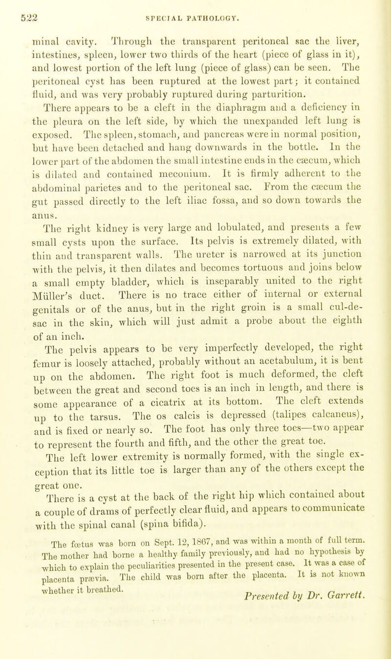 minal cavity. Tliiough tlic transparent pei'itoncal sac the liver, intestines, spleen, lower two thirds of the heart (piece of glass in it), and lowest portion of the left lung (piece of glass) can be seen. The peritoneal cyst has been ruptured at the lowest part; it contained fluid, and was very probably ruptui-ed during parturition. There appears to be a cleft in the diaphragm and a deficiency in the pleura on the left side, by which the unexpanded left lung is exposed. The spleen, stomach, and pancreas were in normal position, but have been detached and hang downwards in the bottle. In the lower part of the abdomen the small intestine ends in the caecum, which is dilated and contained mecouium. It is firmly adherent to the abdominal parietes and to the peritoneal sac. From the caecum the gut passed directly to the left iliac fossa, and so down towards the anus. The right kidney is very large and lobulated, and presents a few small cysts upon the surface. Its pelvis is extremely dilated, with thin and transparent walls. The ureter is narrowed at its junction with the pelvis, it then dilates and becomes tortuous and joins below a small empty bladder, which is inseparably united to the right Miiller's duct. There is no trace either of internal or external genitals or of the anus, but in the right groin is a small cul-de- sac in the skin, which will just admit a probe about the eighth of an inch. The pelvis appears to be very imperfectly developed, the right femur is loosely attached, probably without an acetabulum, it is bent up on the abdomen. The right foot is much deformed, the cleft between the great and second toes is an inch in length, and there is some appearance of a cicatrix at its bottom. The cleft extends up to the tarsus. The os calcis is depressed (talipes calcaneus), and is fixed or nearly so. The foot has only three toes—two appear to represent the fourth and fifth, and the other the great toe. The left lower extremity is normally formed, with the single ex- ception that its little toe is larger than any of the others except the great one. There is a cyst at the back of the right hip which contained about a couple of drams of perfectly clear fluid, and appears to communicate with the spinal canal (spina bifida). The foetus was born on Sept. 12, 1867, and was within a month of full term. The mother had borne a healthy family previously, and had no hypothesis by which to explain the peculiarities presented in the present case. It was a case of placenta prasvia. The child was born after the placenta. It is not known whether it breathed. . j i n n 4i Presented by Dr. Garrett.