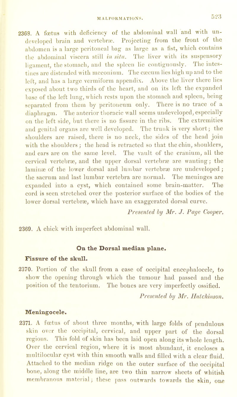 MAI.I'OR.MATKJNS. 2368. A foetus with deficiency of tlic abdominal wall and with un- developed brain and vcrtebrai. Projecting from the front of the abdomen is a large peritoneal bag as large as a fist, which contains the abdominal viscera still hi, situ. The liver with its suspensory ligament, the stomach, and the spleen lie eontignously. The intes- tines are distended with meconium. The caecum lies high up and to the left, and has a large vermiform appendix. Above the liver there lies exposed about two thirds of the heart, and on its left the expanded base of the left lung, which rests upon the stomach and spleen, being separated from them by peritoneum only. There is no trace of a diaphragm. The anterior tiioracic wall seems undeveloped, especially on the left side, but there is no fissure in the ribs. The extremities and genital organs are well developed. The trunk is very short; the shoulders are raised, there is no neck, the sides of the head join with the shoulders ; the head is retracted so that the chin, shoulders, and ears are on the same level. The vault of the cranium, all the cervical vertebrae, and the upper dorsal vertebrae are wanting; the laminae of the lower dorsal and lumbar vertebrae are undeveloped ; the sacrum and last lumbar vertebra are normal. The meninges are expanded into a cyst, which contained some brain-matter. The cord is seen stretched over the posterior surface of the bodies of the lower dorsal vertebrae, which have an exaggerated dorsal curve. Presented by Mr. J. Page Cooper. 2369. A chick with imperfect abdominal wall. On the Dorsal median plane. Fissure of the skull. 2370. Portion of the skull from a case of occipital encephalocele, to show the opening through which the tumour had passed and the position of the tentorium. The bones are very imperfectly ossified. Presented hj Mr. Hutchinson. Meningocele. 2371. A foetus of about three months, with large folds of pendulous skin over the occipital, cervical, and upper part of the dorsal regions. This fold of skin has been laid open along its whole length. Over the cervical region, where it is most abundant, it encloses a multilocular cyst with thin smooth walls and filled with a clear fluid. Attached to the median ridge on the outer surface of the occipital bone, along the middle line, are two thin narrow sheets of whitish membranous material; these pass outwards towards the skin, oixe