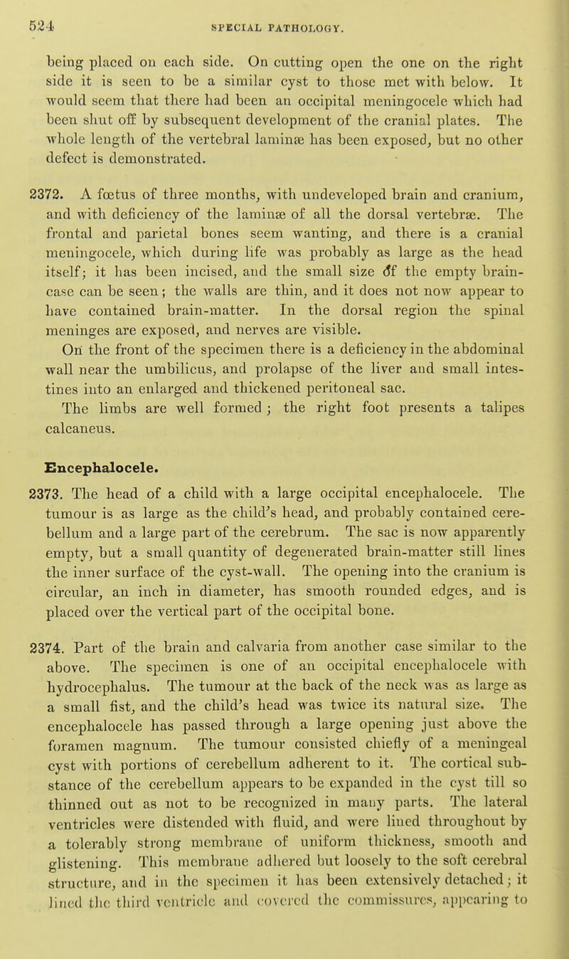 being placed on each side. On cutting open the one on the right side it is seen to be a similar cyst to those met with below. It would seem that there had been an occipital meningocele which had been shut off by subsequent development of the cranial plates. The whole length of the vertebral laminae has been exposed, but no other defect is demonstrated. 2372. A foetus of three months, with undeveloped brain and cranium, and with deficiency of the laminae of all the dorsal vertebrae. The frontal and parietal bones seem wanting, and there is a cranial meningocele, which during life was probably as large as the head itself; it has been incised, and the small size (Jf the empty brain- case can be seen; the walls are thin, and it does not now appear to have contained brain-matter. In the dorsal region the spinal meninges are exposed, and nerves are visible. On the front of the specimen there is a deficiency in the abdominal wall near the umbilicus, and prolapse of the liver and small intes- tines into an enlarged and thickened peritoneal sac. The limbs are well formed ; the right foot presents a talipes calcaneus. Eucephalocele. 2373. The head of a child with a large occipital encephalocele. The tumour is as large as the child^s head, and probably contained cere- bellum and a large part of the cerebrum. The sac is now apparently empty, but a small quantity of degenerated brain-matter still lines the inner surface of the cyst-wall. The opening into the cranium is circular, an inch in diameter, has smooth rounded edges, and is placed over the vertical part of the occipital bone. 2374. Part of the brain and calvaria from another case similar to the above. The specimen is one of an occipital encephalocele with hydrocephalus. The tumour at the back of the neck was as large as a small fist, and the child's head was twice its natural size. The encephalocele has passed through a large opening just above the foramen magnum. The tumour consisted chiefly of a meningeal cyst with portions of cerebellum adherent to it. The cortical sub- stance of the cerebellum appears to be expanded in the cyst till so thinned out as not to be recognized in many parts. The lateral ventricles were distended with fluid, and were lined throughout by a tolerably strong membrane of uniform thickness, smooth and glistening. This membrane adhered but loosely to the soft cerebral structure, and in the specimen it has been extensively detached; it lined tlic thii'd ventricle uud covered the commissures, appearing to