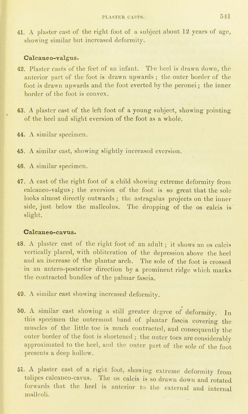 41. A plaster cast of the right foot o£ a subject al)Out 13 years of age, sliowing similar but increased deformity. Caleaneo-valgus. 42. Plaster casts of the feet of au infant. The lieel is drawn down, the anterior part of the foot is draAvn upwards ; the outer border of the foot is drawn upwards and the foot everted by the peronei; the inner border of the foot is convex. 43. A plaster cast of the left foot of a young subject, showing pointing oE the heel and slight eversion of the foot as a whole. 44. A similar specimen. 45. A similar cast, showing slightly increased eversion, 46. A similar specimen. 47. A cast of the right foot of a child showing extreme deformity from calcaneo-valgus; the eversion of the foot is so great that the sole looks almost directly outwards ; the astragalus projects on the inner side, just below the malleolus. The dropping of the os calcis is slight. Calcaneo-cavus. 48. A plaster east of the right foot of an adult; it shows an os calcis vertically placed, with obliteration of the depression above the heel and an increase of the plantar arch. The sole of the foot is crossed in an antero-posterior direction by a prominent ridge which marks the C(mtracted bundles of the palmar fascia. 49. A similar cast showing increased deformity. 50. A similar cast showing a still greater degree of deformity. In this specimen the outermost band of plantar fascia covering the muscles of the little toe is much contracted, and consequently the outer border of the foot is shortened ; the outer toes are considerably approximated to the heel, and the outer part of the sole of the foot presents a deep hollow. 61. A plaster cast of a right foot, showing extreme deformity from talipes calcaneo-cavus. The os calcis is so drawn down and rotated forwards that the heel is anterior to the external and internal malleoli.