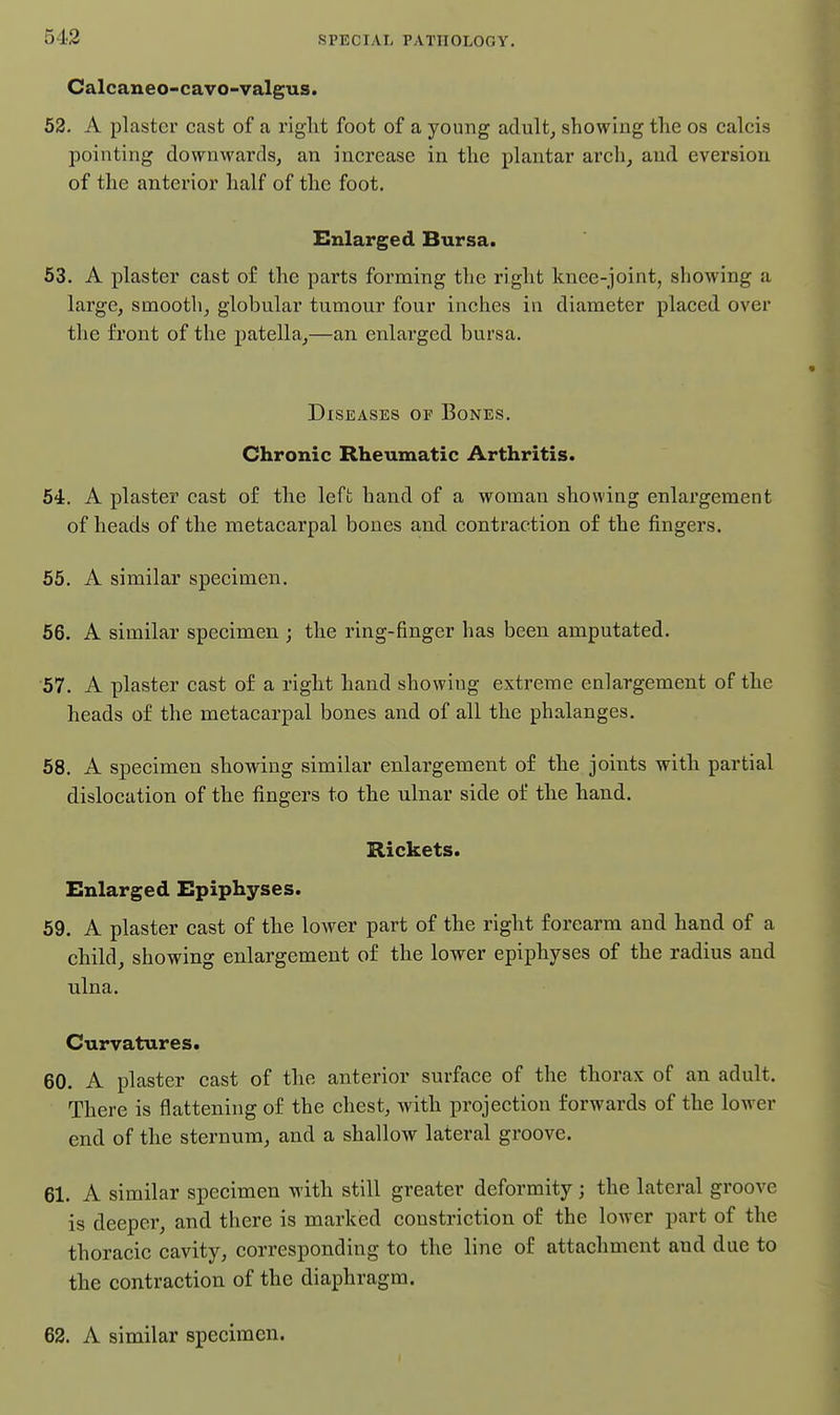 543 Calcaneo-cavo-valgus. 52- A plaster cast of a right foot of a young adult, showing the os calcis pointing downwards, an increase in the plantar arch, and eversion of the anterior half of the foot. Enlarged Bursa. 53. A plaster cast o£ the parts forming the right knee-joint, showing a large, smooth, globular tumour four inches in diameter placed over the front of the patella,—an enlarged bursa. Diseases of Bones. Chronic Rheumatic Arthritis. 54. A plaster cast of the left hand of a woman showing enlargement of heads of the metacarpal bones and contraction of the fingers. 65. A similar specimen. 66. A similar specimen ; the ring-finger has been amputated. 57. A plaster cast o£ a right hand showing extreme enlargement of the heads of the metacarpal bones and of all the phalanges. 68. A specimen showing similar enlargement of the joints with partial dislocation of the fingers to the ulnar side of the hand. Rickets. Enlarged Epiphyses. 59. A plaster cast of the lower part of the right forearm and hand of a child, showing enlargement of the lower epiphyses of the radius and ulna. Curvatures. 60. A plaster cast of the anterior surface of the thorax of an adult. There is flattening of the chest, with projection forwards of the lower end of the sternum, and a shallow lateral groove. 61. A similar specimen with still greater deformity; the lateral groove is deeper, and there is marked constriction of the lower part of the thoracic cavity, corresponding to the line of attachment and due to the contraction of the diaphragm. 62. A similar specimen.