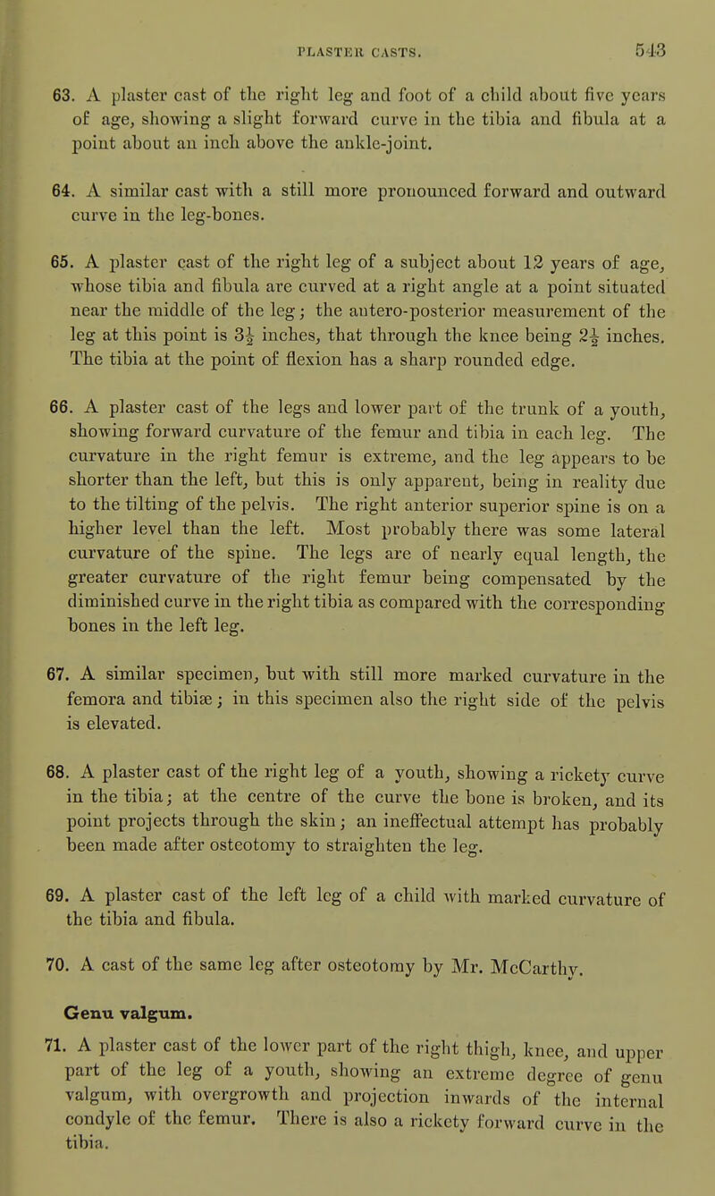 63. A plaster cast of the right leg and foot of a cliild about five years of age, showing a slight forward curve in the tibia and fibula at a point about an inch above the ankle-joint. 64. A similar cast with a still more pronounced forward and outward curve in the leg-bones. 65. A plaster cast of the right leg of a subject about 12 years of age, whose tibia and fibula are curved at a right angle at a point situated near the middle of the leg; the autero-posterior measurement of the leg at this point is 3^ inches, that through the knee being 2^ inches. The tibia at the point of flexion has a sharp rounded edge. 66. A plaster cast of the legs and lower part of the trunk of a youth, showing foi'ward curvature of the femur and tibia in each leg. The curvature in the right femur is extreme, and the leg appears to be shorter than the left, but this is only apparent, being in reality due to the tilting of the pelvis. The right anterior superior spine is on a higher level than the left. Most probably there was some lateral curvature of the spine. The legs are of nearly equal length, the greater curvature of the right femur being compensated by the diminished curve in the right tibia as compared with the corresponding bones in the left leg. 67. A similar specimen, but with still more marked curvature in the femora and tibise; in this specimen also the right side of the pelvis is elevated. 68. A plaster cast of the right leg of a youth, showing a rickety curve in the tibia; at the centre of the curve the bone is broken, and its point projects through the skin; an inefi'ectual attempt has probably been made after osteotomy to straighten the leg. 69. A plaster cast of the left leg of a child with marked curvature of the tibia and fibula. 70. A cast of the same leg after osteotomy by Mr. McCarthy. Genu valgum. 71. A plaster cast of the lower part of the right thigh, knee, and upper part of the leg of a youth, showing an extreme degree of genu valgum, with overgrowth and projection inwards of the internal condyle of the femur. There is also a rickety forward curve in the tibia.