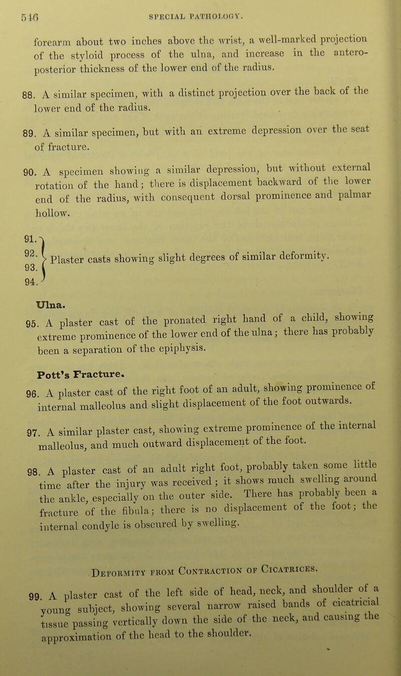 forearm about two inches above the M'rist, a well-marked projection of the styloid process of the ulna, and increase in the antero- posterior thickness of the lower end of the radius. 88. A similar specimen, with a distinct projection over the back of the lower end of the radius. 89. A similar specimen, but with an extreme depression over the seat of fracture. 90. A specimen showing a similar depression, but without external rotation o£ the hand; there is displacement backward of the lower end of the radius, with consequent dorsal prominence and palmar hollow. Plaster casts showing slight degrees of similar deformity. Ulna. 95 A plaster cast of the pronated right hand of a child, showing extreme prominence of the lower end of the ulna; there has probably been a separation of the epiphysis. Pott's Fracture. 96 A plaster cast of the right foot of an adult, showing prominence o£ internal malleolus and slight displacement of the foot outwards. 97. A similar plaster cast, showing extreme prominence of the internal malleolus, and much outward displacement of the foot. 98 A plaster cast of an adult right foot, probably taken some little time after the injury was received; it shows much swellmg around the ankle, especially on the outer side. There has probably been a fracture of the fibula; there is no displacement of the foot; the internal condyle is obscured by swelling. Deformity ruoM Contraction of Cicatrices. 99 A plaster cast of the left side of head, neck, and shoulder of a young subject, showing several narrow raised bands of cicatricial tissue passing vertically down the side of the neck, and causing the approximation of the head to the shoulder.