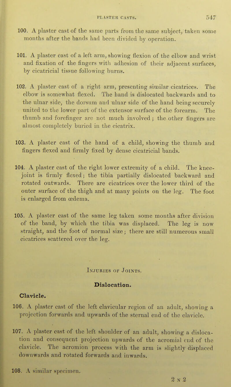 100. A plaster cast of the same parts from the same subject/taken some months after the bands had been divided by operation. 101. A plaster cast of a left arm, showing flexion of the elbow and wrist and fixation of the fingers with adhesion of their adjacent surfaces, by cicatricial tissue following burns. 102. A plaster cast of a right arm, presenting similar cicatrices. The elbow is somewhat flexed. The hand is dislocated backwards and to the ulnar side, the dorsum and ulnar side of the hand being securely united to the lower part of the extensor surface of the forearm. The thumb and forefinger are not much involved; the other fingers are almost completely buried in the cicatrix. 103. A plaster cast of the hand of a child, showing the thumb and fingers flexed and firmly fixed by dense cicatricial bands. 104. A plaster cast of the right lower extremity of a child. The knee- joint is firmly flexed; the tibia partially dislocated backward and rotated outwards. There are cicatrices over the lower third of the outer surface of the thigh and at many points on the leg. The foot is enlarged from oedema. 105. A plaster cast of the same leg taken some months after division of the band, by which the tibia was displaced. The leg is now straight, and the foot of normal size; there are still numerous small cicatrices scattered over the leg. Injuries of Joints. Dislocation. Clavicle. 106. A plaster cast of the left clavicular region of an adult, showing a projection forwards and upwards of the sternal end of the clavicle. 107. A plaster cast of the left shoulder of an adult, showing a disloca- tion and consequent projection upwards of the acromial end of the clavicle. The acromion process with the arm is slightly displaced downwards and rotated forwards and inwards. 108. A similar specimen. 2 N 2