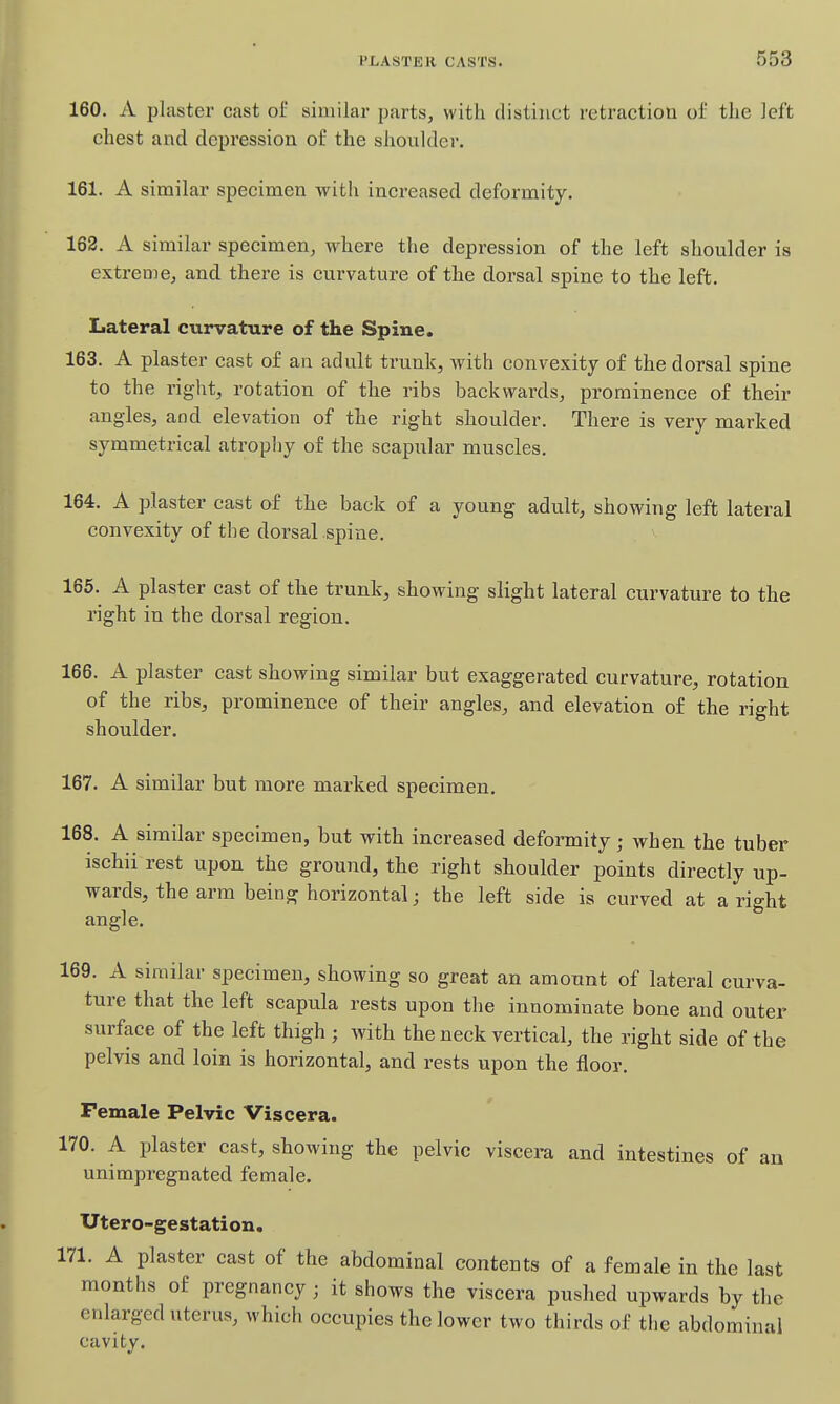 160. A plaster cast of similar parts, with distinct retraction of the left chest and depression of the shoulder. 161. A similar specimen with increased deformity. 162. A similar specimen, where the depression of the left shoulder is extreme, and there is curvature of the dorsal spine to the left. Lateral curvature of the Spine. 163. A plaster cast of an adult trunk, with convexity of the dorsal spine to the right, rotation of the ribs backwards, prominence of their angles, and elevation of the right shoulder. There is very marked symmetrical atropliy of the scapular muscles. 164. A plaster cast of the back of a young adult, showing left lateral convexity of the dorsal spine. 165. A plaster cast of the trunk, showing slight lateral curvature to the right in the dorsal region. 166. A plaster cast showing similar but exaggerated curvature, rotation of the ribs, prominence of their angles, and elevation of the right shoulder. 167. A similar but more marked specimen. 168. A similar specimen, but with increased deformity; when the tuber ischii rest upon the ground, the right shoulder points directly up- wards, the arm being horizontal; the left side is curved at a right angle. 169. A similar specimen, showing so great an amount of lateral curva- ture that the left scapula rests upon the innominate bone and outer surface of the left thigh ; with the neck vertical, the right side of the pelvis and loin is horizontal, and rests upon the floor. Female Pelvic Viscera. 170. A plaster cast, showing the pelvic viscera and intestines of an unimpregnated female. Utero-gestation. 171. A plaster cast of the abdominal contents of a female in the last months of pregnancy ; it shows the viscera pushed upwards by the enlarged uterus, which occupies the lower two thirds of the abdominal cavity.