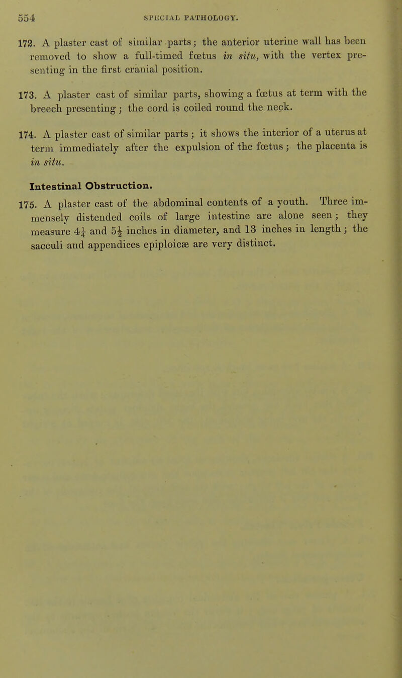 172. A plaster cast of similar parts; the anterior uterine wall lias been removed to show a full-timed foetus in situ, with the vertex pre- senting in the first cranial position. 173. A plaster cast of similar parts, showing a foetus at term with the breech presenting ; the cord is coiled round the neck. 174. A plaster cast of similar parts ; it shows the interior of a uterus at term immediately after the expulsion of the foetus ; the placenta is in situ. Intestinal Obstruction. 175. A plaster cast of the abdominal contents of a youth. Three im- mensely distended coils of large intestine are alone seen; they measure 4^ and 5^ inches in diameter, and 13 inches in length; the sacculi and appendices epiploicae are very distinct.