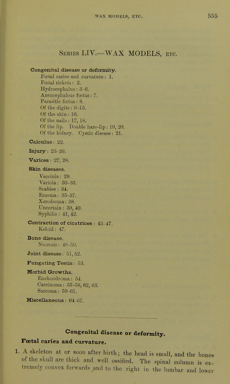 Series LIV.—WAX MODELS, etc. Congenital disease or deformity. Poetal caries and cui'vature : 1. Foetal rickets: 2. Hydroceplialus : 3-6. Anencephalous foetus: 7. Parasitic foetus: 8. Of tlie digits : 9-15. Of tlie skin: 16. Of the nails: 17, 18. Of the lip. Double hare-lip : 19, 20. Of the kidney. Cystic disease: 21. Calculus: 22. Injury: 23-26. Varices: 27, 28. Skin diseases. Vaccinia: 29. Variola: 30-33. Scabies : 34. Eczema: 35-37. Xeroderma: 38. Uncertain : 39, 40. Syphilis : 41, 42. Contraction of cicatrices : 43-47. Keloid: 47. Bone disease. Necrosis: 48-o0. Joint disease: 51, 52. Fungating Testis: 53. Morbid Growths. Enchondi'oma: 64. Carcinoma: 55-58, 62, 63. Sarcoma: 59-61. Miscellaneous: 64-67. Congenital disease or deformity. Foetal caries and curvature. 1. A skeleton at or soon after birth; tlie head is small, and the bones of the skull are thick and well ossified. The spinal column is ex- tremely convex forwards and to the right in the lumbar and lower