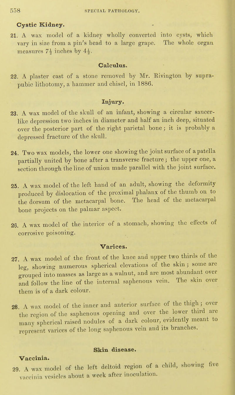 Cystic Kidney. 21. A wax iTioflel of a kidney wholly converted into cysts, which vary in size from a pin^s head to a large grape. The whole organ measures 7^ inches by 4i. Calculus. 22. A plaster cast of a stone removed by Mr. Rivington by supra- pubic lithotomy, a hammer and chisel, in 1886. Injury. 23. A wax model of the skull of an infant, showing a circular saucer- like depression two inches in diameter and half an inch deep, situated over the posterior part of the right parietal bone; it is probably a depressed fracture of the skull. 24. Two wax models^ the lower one showing the joint surface of a patella partially united by bone after a transverse fracture; the upper one, a section through the line of union made parallel with the joint surface. 25. A wax model of the left hand of an adult, showing the deformity produced by dislocation of the proximal phalanx of the thumb on to the dorsum of the metacarpal bone. The head of the metacarpal bone projects on the palmar aspect. 26. A wax model of the interior of a stomach, showing the effects of corrosive poisoning. Varices. 27. A wax model of the front of the knee and upper two thirds of the leg, showing numerous spherical elevations of the skin ; some are grouped into masses as large as a walnut, and are most abundant over and follow the line of the internal saphenous vein. The skin over them is of a dark colour. 28 A wax model of the inner and anterior surface of the thigh; over the region of the saphenous opening and over the lower third are many spherical raised nodules of a dark colour, evidently meant to represent varices of the long saphenous vein and its branches. Skin disease. Vaccinia. 29. A wax model of the left deltoid region of a child, showing five vaccinia vesicles about a week after inoculation.