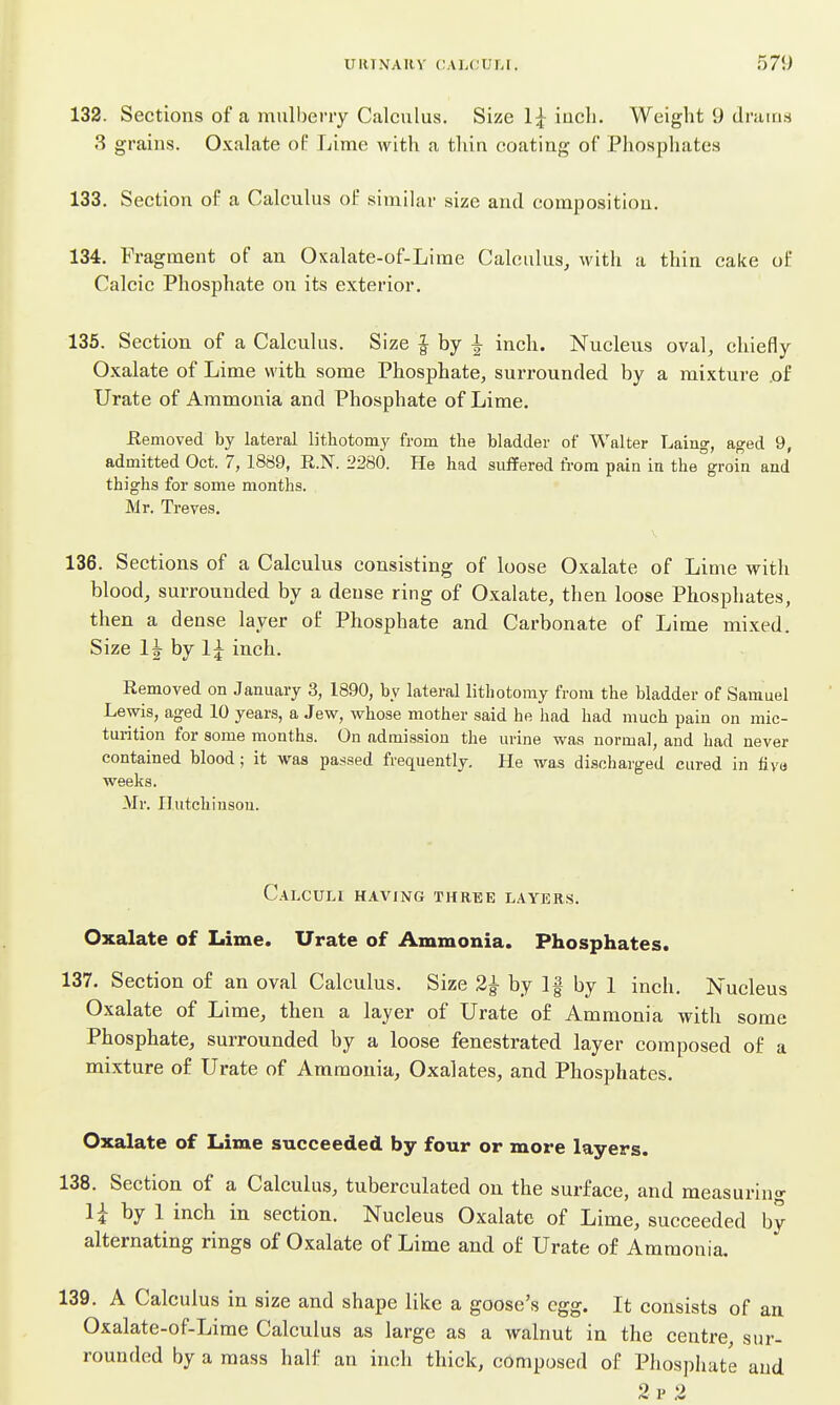 132. Sections of a mulberry Calculus. Size 1;^ inch. Weight 9 drains 3 grains. Oxalate of Lime with a thin coating of Phosphates 133. Section of a Calculus of simihir size and composition. 134. Fragment of an Oxalate-of-Lime Calculus, with a thin cake of Calcic Phosphate on its exterior. 135. Section of a Calculus. Size | by ^ inch. Nucleus oval, chiefly Oxalate of Lime with some Phosphate, surrounded by a mixture .of Urate of Ammonia and Phosphate of Lime. Eemoved by lateral lithotomy from the bladder of Walter Laing, aged 9, admitted Oct. 7, 1889, R.N. 2280. He had suffered from pain in the groin and thighs for some months. Mr. Treves. 136. Sections of a Calculus consisting of loose Oxalate of Lime with blood, surrounded by a dense ring of Oxalate, then loose Phosphates, then a dense layer of Phosphate and Carbonate of Lime mixed. Size 1^ by 1^ inch. Removed on January 3, 1890, by lateral lithotomy from the bladder of Samuel Lewis, aged 10 years, a Jew, whose mother said he had had much pain on mic- turition for some months. On admission the urine was normal, and had never contained blood; it was passed frequently. He was discharged cured in tiya weeks. Mr. Ilutchiusou. Calculi having three layers. Oxalate of Lime. Urate of Ammonia. Phosphates. 137. Section of an oval Calculus. Size 2^ by If by 1 inch. Nucleus Oxalate of Lime, then a layer of Urate of Ammonia with some Phosphate, surrounded by a loose fenestrated layer composed of a mixture of Urate of Ammonia, Oxalates, and Phosphates. Oxalate of Lime succeeded by four or more layers. 138. Section of a Calculus, tuberculated on the surface, and measuring li by 1 inch in section. Nucleus Oxalate of Lime, succeeded by alternating rings of Oxalate of Lime and of Urate of Ammonia. 139. A Calculus in size and shape like a goose's egg. It consists of an Oxalate-of-Lime Calculus as large as a walnut in the centre, sur- rounded by a mass half an inch thick, composed of Phospliate aud 2p 2