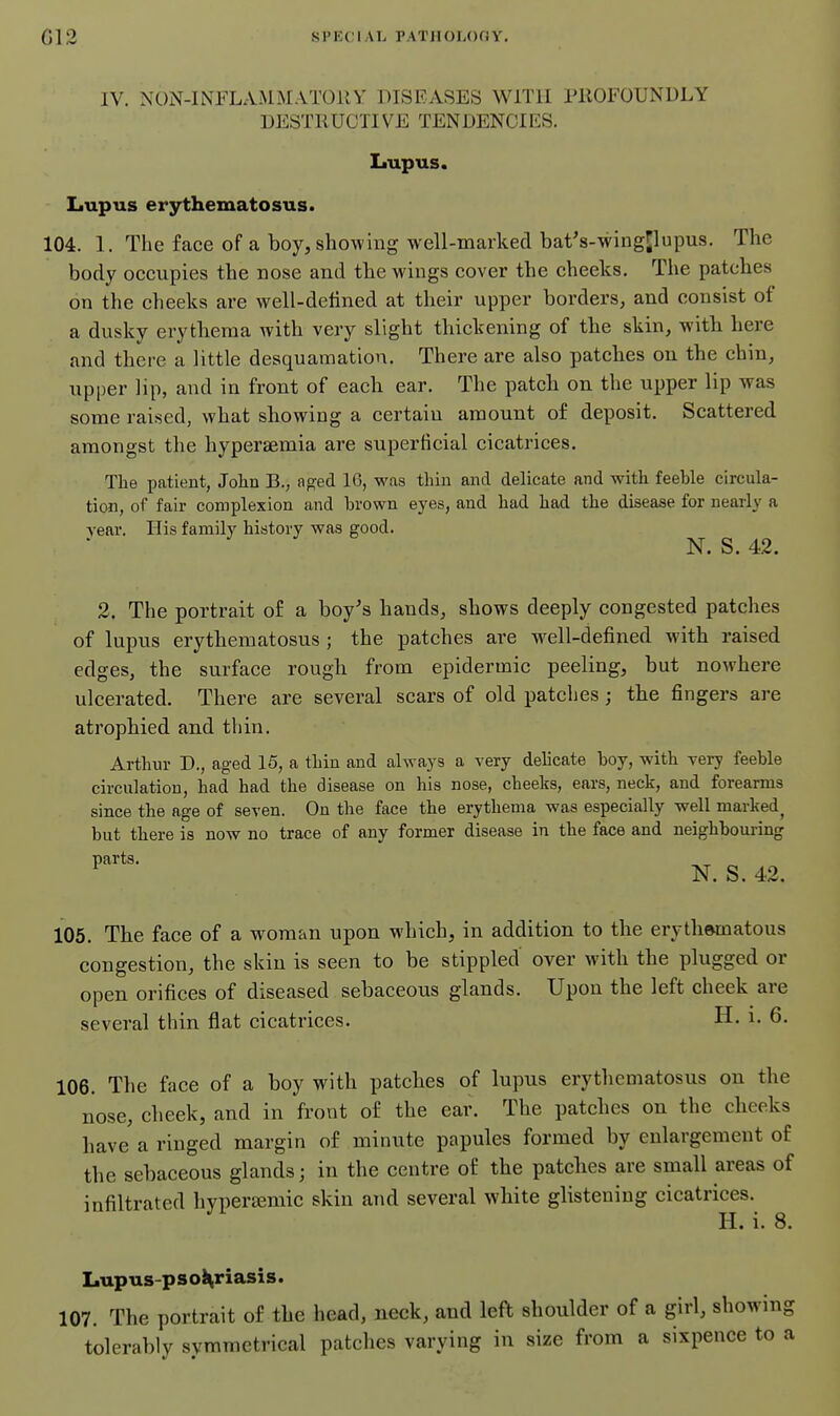 G12 Sl'KCIAL PATJIOI-OOY, IV. NON-INFLAMMATOllY DISEASES WITH PROFOUNDLY DESTRUCTIVE TENDENCIES. Lupus. Lupus erythematosus. 104. 1. The face of a boy, showing well-marked bat's-wingflupus. The body occupies the nose and the wings cover the cheeks. The patches on the cheeks are well-detined at their upper borders, and consist of a dusky erythema with very slight thickening of the skin, with here and there a little desquamation. There are also patches on the chin, upper lip, and in front of each ear. The patch on the upper lip was some raised, what showing a certain amount of deposit. Scattered amongst the hypersemia are superficial cicatrices. The patient, John B., ap^ed 16, was thin and delicate and with feeble circula- tion, of fair complexion and brown eyes, and had had the disease for nearly a rear. His family history was good. N. S. 42. 2. The portrait of a boy's hands, shows deeply congested patches of lupus erythematosus ; the patches are well-defined with raised edges, the surface rough from epidermic peeling, but nowhere ulcerated. There are several scars of old patches; the fingers are atrophied and thin. Arthur D., aged 15, a thin and always a very dehcate boy, with very feeble circulation, had had the disease on his nose, cheeks, ears, neck, and forearms since the age of seven. On the face the erythema was especially well marked^ but there is now no trace of any former disease in the face and neighbouring N. S. 42. 105. The face of a woman upon which, in addition to the erythamatous congestion, the skin is seen to be stippled over with the plugged or open orifices of diseased sebaceous glands. Upon the left cheek are several thin flat cicatrices. H. i. 6. 106. The face of a boy with patches of lupus erythematosus on the nose, cheek, and in front of the ear. The patches on the cheeks have a ringed margin of minute papules formed by enlargement of the sebaceous glands; in the centre of the patches are small areas of infiltrated hvperamic skin and several white glistening cicatrices. H. i. 8. Lupus-pso^riasis. 107. The portrait of the head, neck, and left shoulder of a girl, showing tolerably symmetrical patches varying in size from a sixpence to a