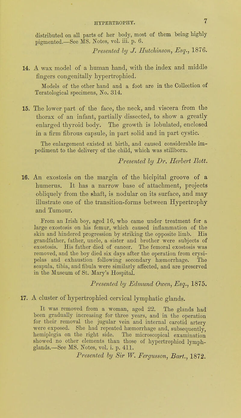 distributed on all parts of her body, most of them being highly pigmented.—See MS. Notes, vol. iii. p. 6. Presented by J. Hutchinson, Esq., 1876. 14. A wax model of a human hand, with the index and middle fingers congenitally hypertrophied. Models of the other hand and a foot are in the Collection of Teratological specimens, No. 314. 15. The lower part of the face, the neck, and viscera from the thorax of an infant, partially dissected, to show a greatly enlarged thyroid body. The growth is lobulated, enclosed in a firm fibrous capsule, in pai't solid and in part cystic. The enlargement existed at birth, and caused considerable im- pediment to the delivery of the child, which was stillborn. Presented by Dr. Herbert Ilott. 16. An exostosis on the margin of the bicipital groove of a humerus. It has a narrow base of attachment, projects obliquely from the shaft, is nodular on its surface, and may illustrate one of the transition-forms between Hypertrophy and Tumoui. From an Irish boy, aged 16, who came under treatment for a large exostosis on his femur, which caused inflammation of the skin and hindered progression by striking the opposite limb. His grandfather, father, uncle, a sister and brother were subjects of exostosis. His father died of cancer. The femoral exostosis was removed, and the boy died six days after the operation from erysi- pelas and exhaustion following secondary hfemorrhage. The scapula, tibia, and fibula were similarly affected, and are preserved in the Museum of St. Mary's Hospital. Presented by Edmund Owen, Esq., 1875. 17. A cluster of hypertrophied cervical lymphatic glands. It was removed from a woman, aged 22. The glands had been gradually increasing for three years, and in the operation for their removal the jugular vein and internal carotid artery were exposed. She had repeated hfemorrhage and, subsequently, hemiplegia on the right side. The microscopical examination showed no other elements than those of hypertrophied lymph- glands.—See MS. Notes, vol. i. p. 411. Presented by Sir W. Fergusson, Bart., 1872.