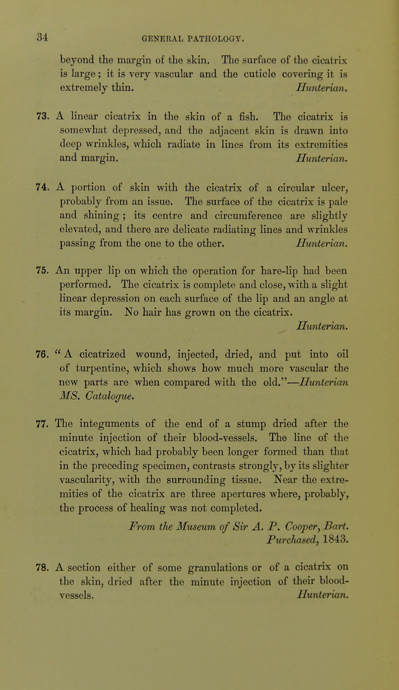 beyond the margin of the skm. The surface of the cicatrix is large; it is very vascular and the cuticle covering it is extremely thin. Hunterian. 73. A linear cicatrix in the skin of a fish. The cicatrix is somewhat depressed, and the adjacent skin is drawn into deep wrinkles, which radiate in lines from its extremities and margin. Hunterian. 74. A portion of skin with the cicatrix of a circular ulcer, probably from an issue. The surface of the cicatrix is pale and shining; its centre and circumference are slightly elevated, and there are delicate radiating lines and wrinkles passing from the one to the other. Hunterian. 75. An upper lip on which the operation for hare-lip had been performed. The cicatrix is complete and close, with a slight linear depression on each surface of the lip and an angle at its margin. No hair has grown on the cicatrix. Hunterian. 76.  A cicatrized wound, injected, dried, and put into oil of turpentine, which shows how much more vascular the new parts are when compared with the old.—Hunterian MS, Catalogue. 77. The integuments of the end of a stump dried after the minute injection of their blood-vessels. The line of the cicatrix, which had probably been longer formed than that in the preceding specimen, contrasts strongly, by its slighter vascularity, with the surrounding tissue. Near the extre- mities of the cicatrix are three apertures where, probably, the process of healing was not completed. From the Museum of Sir A. P. Cooper, Bart. Purchased, 1843. 78. A section either of some granulations or of a cicatrix on the skin, dried after the minute injection of their blood- vessels. Hunterian.