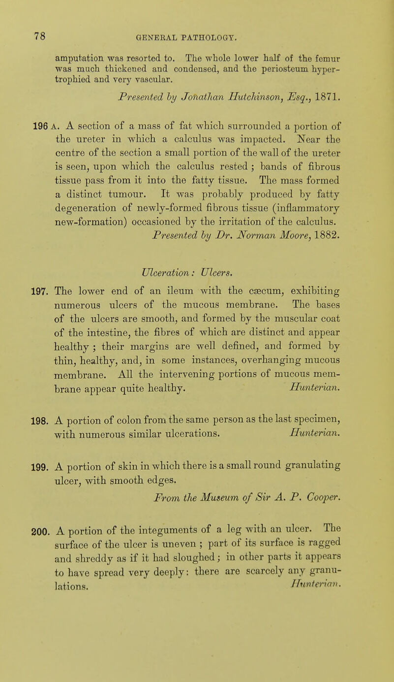 amputation was resorted to. The whole lower half of the femur was much thickeued and condensed, and the periosteum hyper- trophied and very vascular. Presented hy Jofiathan Hutchinson, Esq., 1871. 196 A. A section of a mass of fat which surrounded a portion of the ureter in which a calculus was impacted. Near the centre of the section a small portion of the wall of the ureter is seen, upon which the calculus rested ; bands of fibrous tissue pass from it into the fatty tissue. The mass formed a distinct tumour. It was probably produced by fatty degeneration of newly-formed fibrous tissue (inflammatory new-formation) occasioned by the irritation of the calculus. Presented hy Dr. Norman Moore, 1882. Ulceration: Ulcers. 197. The lower end of an ileum with the ctecum, exhibiting numerous ulcers of the mucous membrane. The bases of the ulcers are smooth, and formed by the muscular coat of the intestine, the fibres of which are distinct and appear healthy ; their margins are well defined, and formed by thin, healthy, and, in some instances, overhanging mucous membrane. All the intervening portions of mucous mem- brane appear quite healthy. Hunterian. 198. A portion of colon from the same person as the last specimen, with numerous similar ulcerations. Hunterian. 199. A portion of skin in which there is a small round granulating ulcer, with smooth edges. From the Museum of Sir A. P. Cooper. 200. A portion of the integuments of a leg with an ulcer. The surface of the ulcer is uneven ; part of its surface is ragged and shreddy as if it had sloughed; in other parts it appears to have spread very deeply: there are scarcely any granu- lations. Hunteriav.