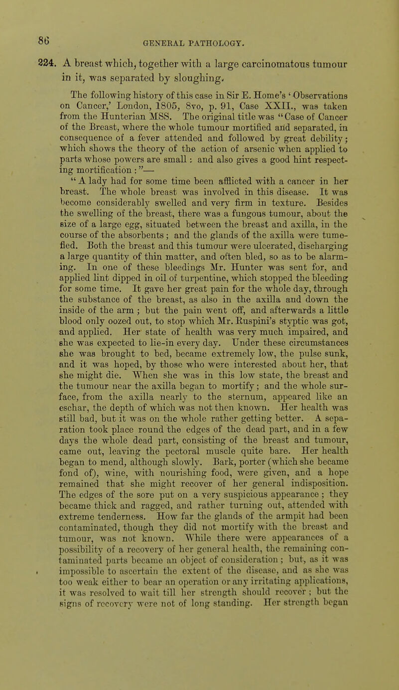 224. A breast wbichj together with a large carcinomatous tumour in it, was separated bj sloughing. The following history of this case in Sir E. Home's ' Observations on Cancer,' London, 1805, 8vo, p, 91, Case XXII., was taken from the Huntorian MSS. The original title was Case of Cancer of the Breast, where the whole tumour mortified arid separated, in consequence of a fever attended and followed by great debility; which shows the theory of the action of arsenic when applied to parts whose powers are small; and also gives a good hint respect- ing mortification:—  A lady had for some time been afflicted with a cancer in her breast. The whole breast was involved in this disease. It was become considerably swelled and very firm in texture. Besides the swelling of the breast, there was a fungous tumour, about the size of a large egg, situated between the breast and axUla, in the course of the absorbents ; and the glands of the axilla were tume- fied. Both the breast and this tumour were ulcerated, discharging a large quantity of thin matter, and often bled, so as to be alarm- ing. In one of these bleedings Mr. Hunter was sent for, and applied lint dipped in oil of turpentine, which stopped the bleeding for some time. It gave her great pain for the whole day, through the substance of the breast, as also in the axilla and down the inside of the arm ; but the pain went off, and afterwards a little blood only oozed out, to stop which Mr. Euspini's styptic was got, and applied. Her state of health was very much impaired, and she was expected to lie-in every day. Under these circumstances she was brought to bed, became extremely low, the pulse sunk, and it was hoped, by those who were interested about her, that she might die. When she was in this low state, the breast and the tumour near the axilla began to mortify; and the whole sur- face, from the axilla nearly to the sternum, appeared like an eschar, the depth of which was not then known. Her health was still bad, but it was on the whole rather getting better. A sepa- ration took place round the edges of the dead part, and in a few days the whole dead part, consisting of the breast and tumour, came out, leaving the pectoral muscle quite bare. Her health began to mend, although slowly. Bark, porter (which she became fond of), wine, with nourishing food, were given, and a hope remained that she might recover of her general indisposition. The edges of the sore put on a very suspicious appearance ; they became thick and ragged, and rather turning out, attended with extreme tenderness. How far the glands of the armpit had been contaminated, though they did not mortify with the breast and tumour, was not known. While there were appearances of a possibility of a recovery of her general health, the remaining con- taminated parts became an object of consideration ; but, as it was impossible to ascertain the extent of the disease, and as she was too weak either to bear an operation or any irritating applications, it was resolved to wait till her strength should recover ; but the signs of recovery were not of long standing. Her strength began