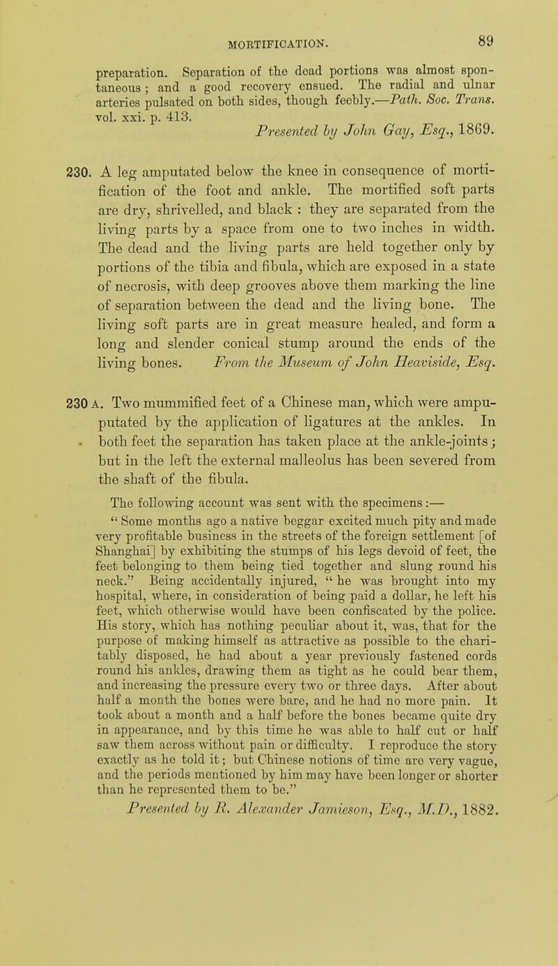 preparation. Separation of tho dead portions was almost spon- taneous ; and a good recovery ensued. The radial and ulnar arteries pulsated on both sides, though feebly.—Path. Soc. Trans. vol. xxi. p. 413. Presented hy John Gay, Esq., 1869. 230. A leg amputated below the knee in consequence of morti- fication of the foot and ankle. The mortified soft parts are dry, shrivelled, and black : they are separated from the living parts by a space from one to two inches in vndth. The dead and the living parts are held together only by portions of the tibia and fibula, which are exposed in a state of necrosis, with deep grooves above them marking the line of separation between the dead and the living bone. The living soft parts are in great measure healed, and form a long and slender conical stump around the ends of the living bones. From the Museum of John Heaviside, Esq. 230 A. Two mummified feet of a Chinese man, which were ampu- putated by the application of ligatures at the ankles. In . both feet the separation has taken place at the ankle-joints; but in the left the external malleolus has been severed from the shaft of the fibula. The following account was sent with the specimens:—  Some months ago a native beggar excited much pity and made very profitable business in the streets of the foreign settlement [of Shanghai] by exhibiting the stumps of his legs devoid of feet, the feet belonging to them being tied together and slung round his neck. Being accidentally injured,  he was brought into my hospital, where, in consideration of being paid a dollar, he left his feet, which otherwise would have been confiscated by the police. His story, which has nothing pecuhar about it, was, that for the purpose of making himself as attractive as possible to the chari- tably disposed, he had about a year previously fastened cords round his anldes, drawing them as tight as he could bear them, and increasing the pressure every two or three days. After about half a month the bones were bare, and he had no more pain. It took about a month and a half before the boues became quite dry in appearance, and by this time he was able to half cut or half saw them across without pain or difficulty. I reproduce the story exactly as he told it; but Chinese notions of time are very vague, and the periods mentioned by him may have been longer or shorter than he represented them to be. Presented by R. Alexander Jamieson, Esq., M.T)., 1882.