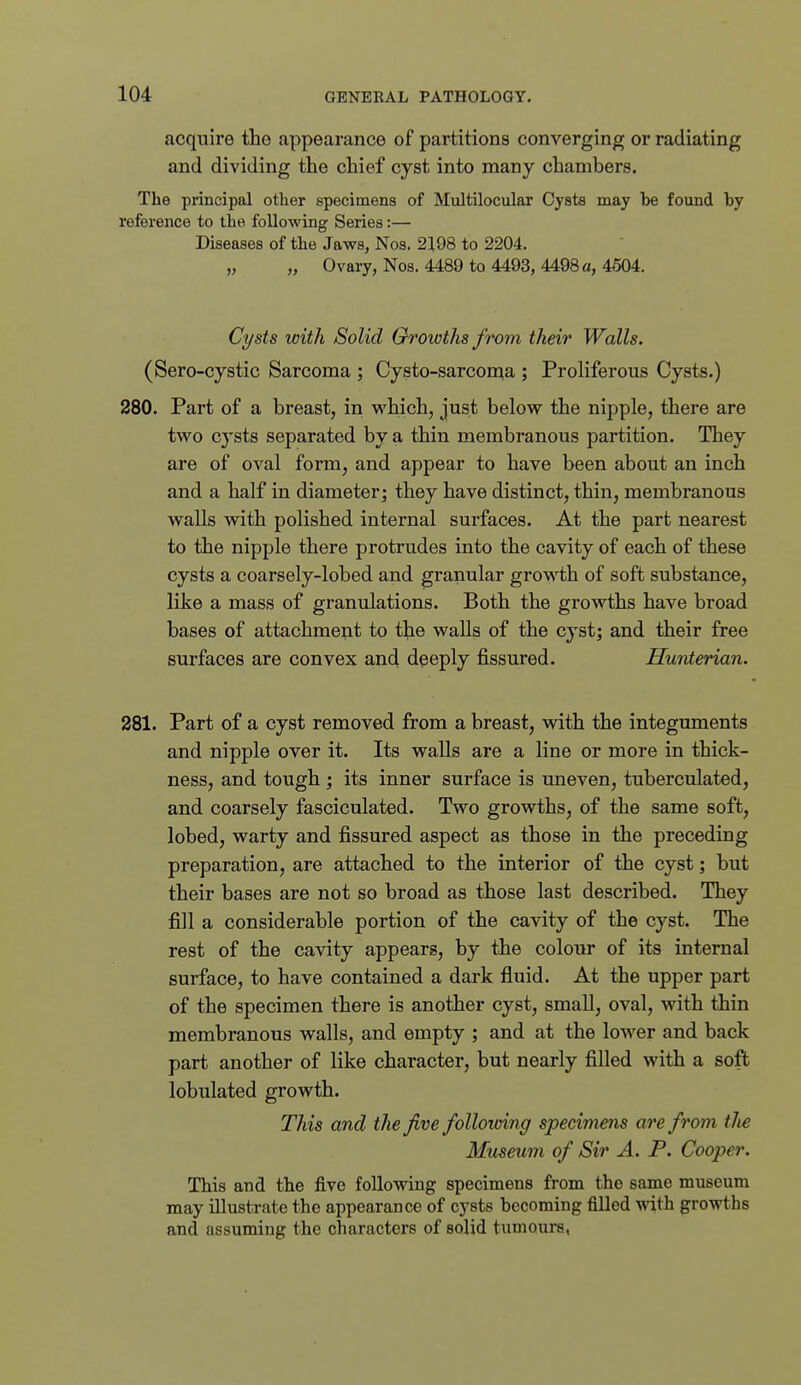 acquire the appearance of partitions converging or radiating and dividing the chief cyst into many chambers. The principal other specimens of Multilocular Cysts may be found by reference to the following Series:— Diseases of the Jaws, Nos. 2198 to 2204. „ „ Ovary, Nos. 4489 to 4493, 4498 a, 4504. Ci/sts with Solid Orowths from their Walls. (Sero-cystic Sarcoma ; Cysto-sarcon^a ; Proliferous Cysts.) 280. Part of a breast, in which, just below the nipple, there are two cysts separated by a thin membranous partition. They are of oval form, and appear to have been about an inch and a half in diameter; they have distinct, thin, membranous walls with polished internal surfaces. At the part nearest to the nipple there protrudes into the cavity of each of these cysts a coarsely-lobed and granular growth of soft substance, like a mass of granulations. Both the growths have broad bases of attachmeut to the walls of the cyst; and their free surfaces are convex and deeply fissured. Hunterian. 281. Part of a cyst removed from a breast, with the integuments and nipple over it. Its walls are a line or more in thick- ness, and tough ; its inner surface is uneven, tuberculated, and coarsely fasciculated. Two growths, of the same soft, lobed, warty and fissured aspect as those in the preceding preparation, are attached to the interior of the cyst; but their bases are not so broad as those last described. They fill a considerable portion of the cavity of the cyst. The rest of the cavity appears, by the colour of its internal surface, to have contained a dark fluid. At the upper part of the specimen there is another cyst, small, oval, with thin membranous walls, and empty ; and at the lower and back part another of like character, but nearly filled with a soft lobulated growth. This and the five following specimens are from the Museum of Sir A. P. Cooper. This and the five following specimens from the same museum may illustrate the appearance of cysts becoming filled with growths and assuming the characters of solid tumours,