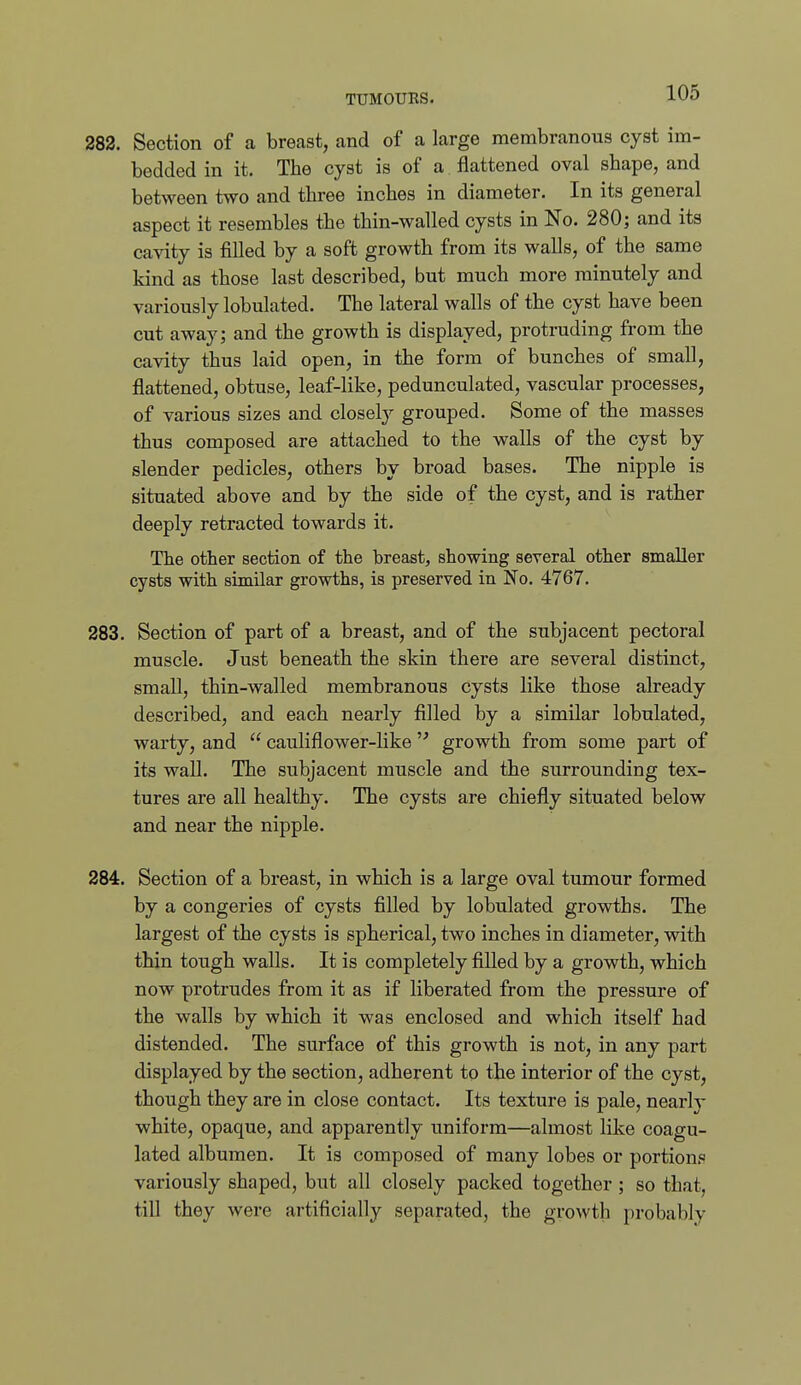 283. Section of a breast, and of a large membranous cyst im- bedded in it. The cyst is of a flattened oval shape, and between two and three inches in diameter. In its general aspect it resembles the thin-walled cysts in No. 280; and its cavity is filled by a soft growth from its walls, of the same kind as those last described, but much more minutely and variously lobulated. The lateral walls of the cyst have been cut away; and the growth is displayed, protruding from the cavity thus laid open, in the form of bunches of small, flattened, obtuse, leaf-like, pedunculated, vascular processes, of various sizes and closely grouped. Some of the masses thus composed are attached to the walls of the cyst by slender pedicles, others by broad bases. The nipple is situated above and by the side of the cyst, and is rather deeply retracted towards it. The other section of the breast, showing several other smaller cysts with similar growths, is preserved in No. 4767. 283. Section of part of a breast, and of the subjacent pectoral muscle. Just beneath the skin there are several distinct, small, thin-walled membranous cysts like those already described, and each nearly filled by a similar lobulated, warty, and  cauliflower-like  growth from some part of its wall. The subjacent muscle and the surrounding tex- tures are all healthy. The cysts are chiefly situated below and near the nipple. 284. Section of a breast, in which is a large oval tumour formed by a congeries of cysts filled by lobulated growths. The largest of the cysts is spherical, two inches in diameter, with thin tough walls. It is completely filled by a growth, which now protrudes from it as if liberated from the pressure of the walls by which it was enclosed and which itself had distended. The surface of this growth is not, in any part displayed by the section, adherent to the interior of the cyst, though they are in close contact. Its texture is pale, nearlj- white, opaque, and apparently uniform—almost like coagu- lated albumen. It is composed of many lobes or portions variously shaped, but all closely packed together ; so that, till they were artificially separated, the growth probably