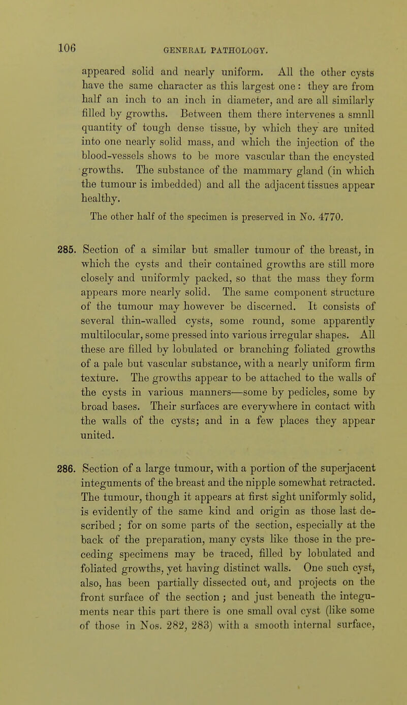 appeared solid and nearly uniform. All the other cysts have the same character as this largest one : they are from half an inch to an inch in diameter, and are all similarly filled by growths. Between them there intervenes a smnll quantity of tough dense tissue, by which they are united into one nearly solid mass, and which the injection of the blood-vessels shows to be more vascular than the encysted growths. The substance of the mammary gland (in which the tumour is imbedded) and all the adjacent tissues appear healthy. The other half of the specimen is preserved in No. 4770. 285. Section of a similar but smaller tumour of the breast, in which the cysts and their contained growths are still more closely and uniformly packed, so that the mass they form appears more nearly solid. The same component structure of the tumour may however be discerned. It consists of several thin-walled cysts, some round, some apparently multilocular, some pressed into various irregular shapes. All these are filled by lobulated or branching foliated growths of a pale but vascular substance, with a nearly uniform firm texture. The growths appear to be attached to the walls of the cysts in various manners—some by pedicles, some by broad bases. Their surfaces are everywhere in contact with the walls of the cysts; and in a few places they appear united. 286. Section of a large tumour, with a portion of the superjacent integuments of the breast and the nipple somewhat retracted. The tumour, though it appears at first sight uniformly solid, is evidently of the same kind and origin as those last de- scribed ; for on some parts of the section, especially at the back of the preparation, many cysts like those in the pre- ceding specimens may be traced, filled by lobulated and foliated growths, yet having distinct walls. One such cyst, also, has been partially dissected out, and projects on the front surface of the section; and just beneath the integu- ments near this part there is one small oval cyst (like some of those in Nos. 282, 283) with a smooth internal surface,