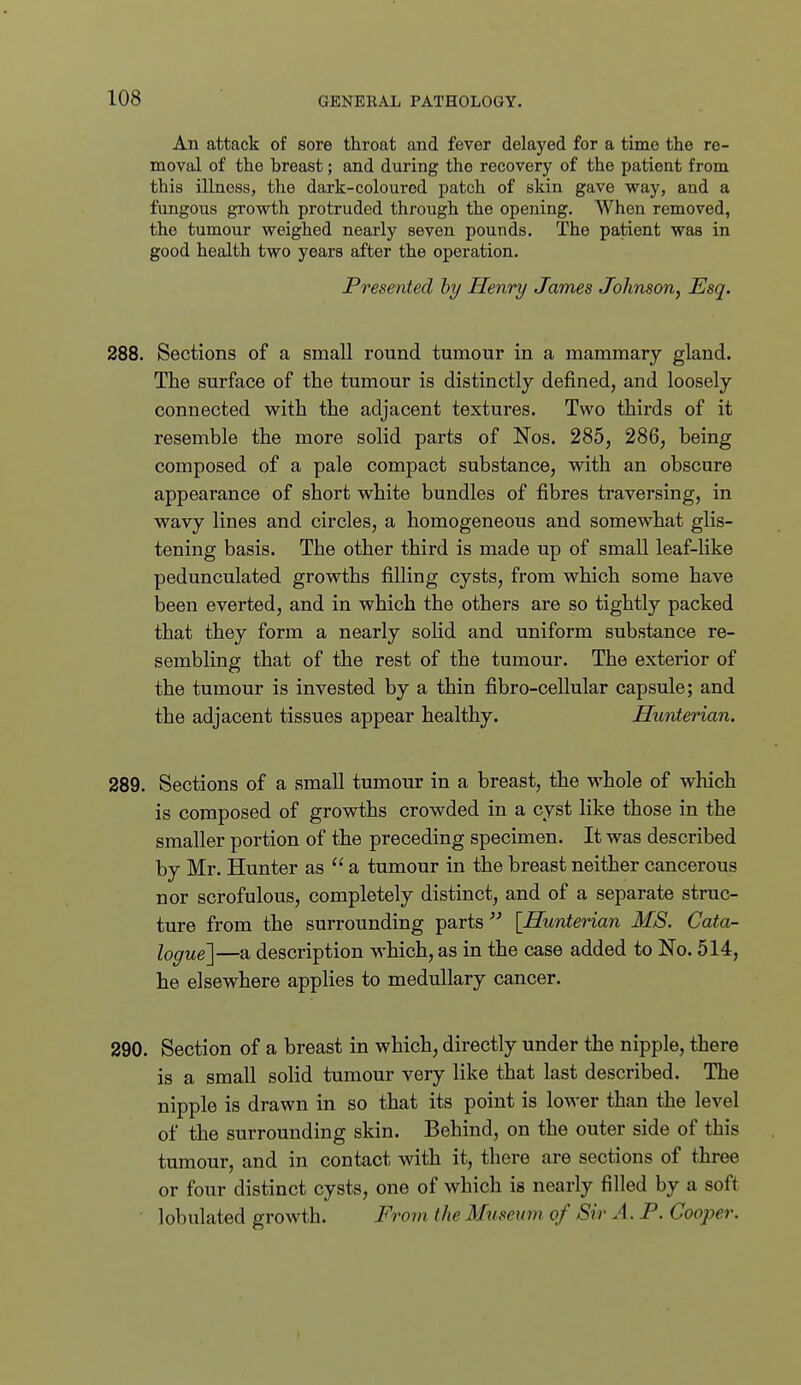 An attack of sore throat and fever delayed for a time the re- moval of the breast; and during the recovery of the patient from this illness, the dark-coloured patch of skin gave way, and a fungous growth protruded through the opening. When removed, the tumour weighed nearly seven pounds. The patient was in good health two years after the operation. Presented hy Henry James Johnson, Esq. 288. Sections of a small round tumour in a mammary gland. The surface of the tumour is distinctly defined, and loosely connected with the adjacent textures. Two thirds of it resemble the more solid parts of Nos. 285, 286, being composed of a pale compact substance, mth an obscure appearance of short white bundles of fibres traversing, in wavy lines and circles, a homogeneous and somewhat glis- tening basis. The other third is made up of small leaf-like pedunculated growths filling cysts, from which some have been everted, and in which the others are so tightly packed that they form a nearly solid and uniform substance re- sembling that of the rest of the tumour. The exterior of the tumour is invested by a thin fibro-cellular capsule; and the adjacent tissues appear healthy. Hunterian. 289. Sections of a small tumour in a breast, the whole of which is composed of growths crowded in a cyst like those in the smaller portion of the preceding specimen. It was described by Mr. Hunter as  a tumour in the breast neither cancerous nor scrofulous, completely distinct, and of a separate struc- ture from the surrounding parts [Hunterian MS. Cata- logue]—a description which, as in the case added to No. 514, he elsewhere applies to medullary cancer. 290. Section of a breast in which, directly under the nipple, there is a small solid tumour very like that last described. The nipple is drawn in so that its point is lower than the level of the surrounding skin. Behind, on the outer side of this tumour, and in contact with it, there are sections of three or four distinct cysts, one of which is nearly filled by a soft lobulated growth. Froin the Mvseimi of Sir A. P. Cooper.