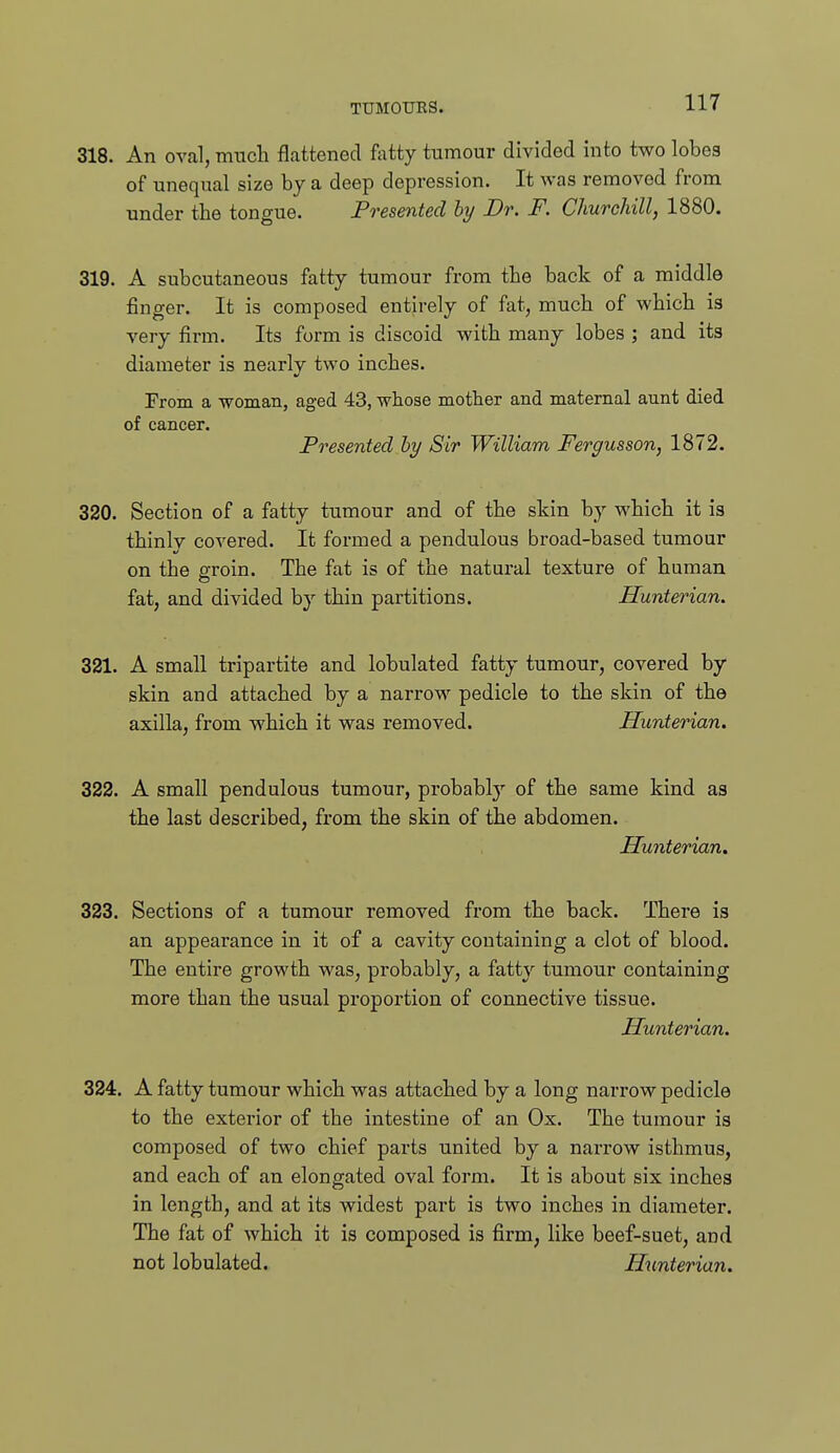 318. An oval, much flattened fatty tumour divided into two lobes of unequal size by a deep depression. It was removed from under the tongue. Presented hy Dr. F. Churchill, 1880. 319. A subcutaneous fatty tumour from the back of a middle finger. It is composed entirely of fat, much of which is very firm. Its form is discoid with many lobes ; and its diameter is nearly two inches. From a woman, aged 43, whose mother and maternal aunt died of cancer. Presented hy Sir William Fergusson, 1872. 320. Section of a fatty tumour and of the skin by which it is thinly covered. It formed a pendulous broad-based tumour on the groin. The fat is of the natural texture of human fat, and divided by thin partitions. Hunterian. 321. A small tripartite and lobulated fatty tumour, covered by skin and attached by a narrow pedicle to the skin of the axilla, from which it was removed. Hunterian. 322. A small pendulous tumour, probably of the same kind as the last described, from the skin of the abdomen. Hunterian. 323. Sections of a tumour removed from the back. There is an appearance in it of a cavity containing a clot of blood. The entire growth was, probably, a fatty tumour containing more than the usual proportion of connective tissue. Hunterian. 324. A fatty tumour which was attached by a long narrow pedicle to the exterior of the intestine of an Ox. The tumour is composed of two chief parts united by a narrow isthmus, and each of an elongated oval form. It is about six inches in length, and at its widest part is two inches in diameter. The fat of which it is composed is firm, like beef-suet, and not lobulated. Hunterian.