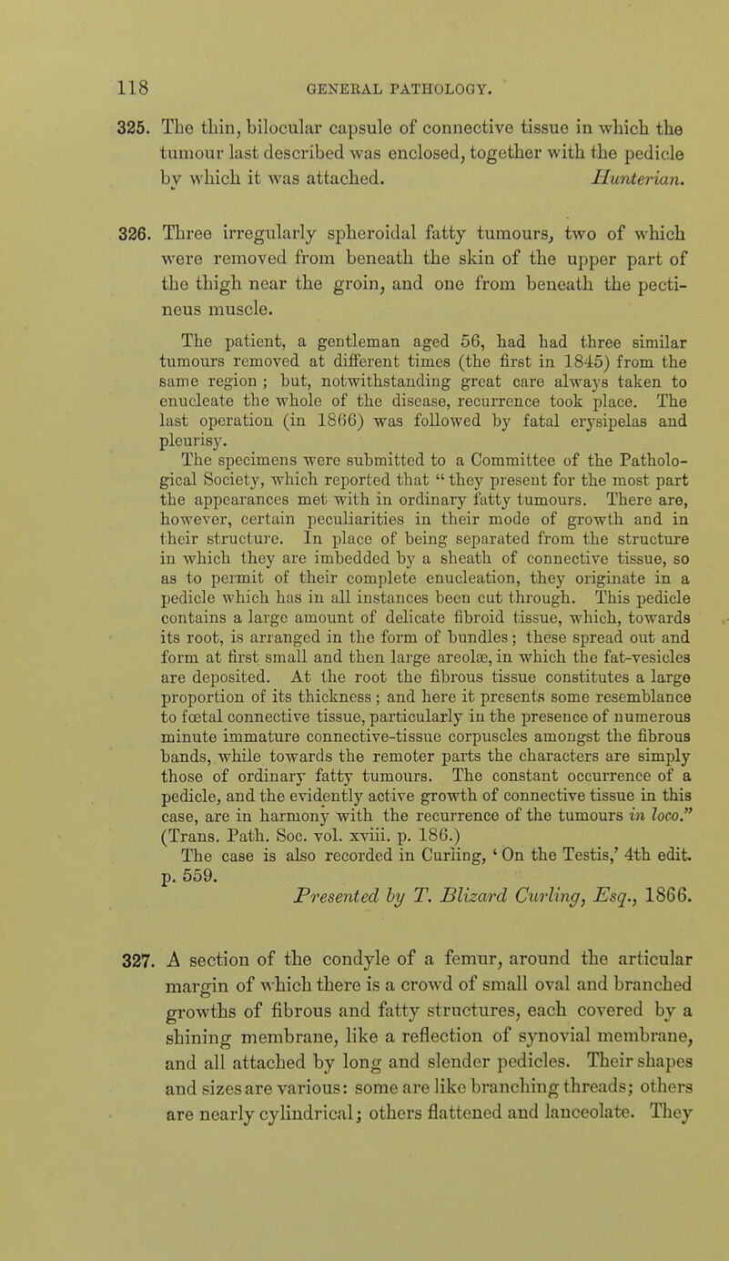 326. The thin, bilocular capsule of connective tissue in which the tumour last described was enclosed, together with the pedicle by which it was attached. Hunterian. 326. Three irregularly spheroidal fatty tumours, two of which were removed from beneath the skin of the upper part of the thigh near the groin, and one from beneath the pecti- neus muscle. The patient, a gentleman aged 56, had had three similar tumours removed at different times (the first in 1845) from the same region ; but, notwithstanding great care always taken to enucleate the whole of the disease, recurrence took place. The last operation (in 1866) was followed by fatal erysipelas and pleurisy. The specimens were submitted to a Committee of the Patholo- gical Society, which reported that  they present for the most part the appearances met with in ordinary fatty tumours. There are, however, certain peculiarities in their mode of growth and in their structure. In place of being separated from the structure in which they are imbedded by a sheath of connective tissue, so as to permit of their complete enucleation, they originate in a pedicle which has in all instances been cut through. This pedicle contains a large amoimt of delicate fibroid tissue, which, towards its root, is arranged in the form of bundles; these spread out and form at first small and then large areolae, in which the fat-vesicles are deposited. At the root the fibrous tissue constitutes a large proportion of its thickness; and here it presents some resemblance to foetal connective tissue, particularly in the presence of numerous minute immature connective-tissue corpuscles amongst the fibrous bands, while towards the remoter parts the characters are simply those of ordinary fatty tumours. The constant occurrence of a pedicle, and the evidently active growth of connective tissue in this case, are in harmony with the recurrence of the tumours in loco. (Trans. Path. Soc. vol. xviii. p. 186.) The case is also recorded in Curling, ' On the Testis,' 4th edit, p. 559. Presented by T. Blizard Curling, Esq., 1866. 327. A section of the condyle of a femur, around the articular margin of which there is a crowd of small oval and branched growths of fibrous and fatty structures, each covered by a shining membrane, like a reflection of synovial membrane, and all attached by long and slender pedicles. Their shapes and sizes are various: some are like branching threads; others are neaidy cylindrical j others flattened and lanceolate. They
