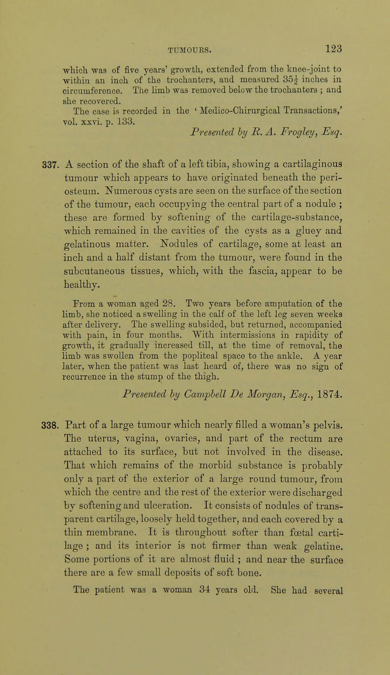 which was of five years' growth, extended from the knee-joint to within an inch of the trochanters, and measured 35| inches in circumference. The limb was removed below the trochanters ; and she recovered. The case is recorded in the ' Medico-Chirurgical Transactions,' vol. xxvi. p. 133. Presented hy R. A. Frogley, Esq. 337. A section of the shaft of a left tibia, showing a cartilaginous tumour which appears to have originated beneath the peri- osteum. Numerous cysts are seen on the surface of the section of the tumour, each occupying the central part of a nodule ; these are formed by softening of the cartilage-substance, which remained in the cavities of the cysts as a gluey and gelatinous matter. Nodules of cartilage, some at least an inch and a half distant from the tumour, were found in the subcutaneous tissues, which, with the fascia, appear to be healthy. From a woman aged 28, Two years before amputation of the limb, she noticed a swelling in the calf of the left leg seven weeks after delivery. The swelling subsided, but returned, accompanied with pain, in four months. With intermissions in rapidity of growth, it gradually increased till, at the time of removal, the limb was swollen from the popliteal space to the ankle. A year later, when the patient was last heard of, there was no sign of recurrence in the stump of the thigh. Presented hy Campbell De Morgan, Esq., 1874. 338. Part of a large tumour which nearly filled a woman's pelvis. The uterus, vagina, ovaries, and part of the rectum are attached to its surface, but not involved in the disease. That which remains of the morbid substance is probably only a part of the exterior of a large round tumour, from which the centre and the rest of the exterior were discharged by softening and ulceration. It consists of nodules of trans- parent cartilage, loosely held together, and each covered by a thin membrane. It is throughout softer than foetal carti- lage ; and its interior is not firmer than weak gelatine. Some portions of it are almost fluid ; and near the surface there are a few small deposits of soft bone. The patient was a woman 34 years old. She had several