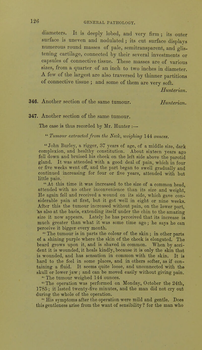 diameters. It is deeply lobed, and very firm ; its outer surface is uneven and nodulated ; its cut surface displays numerous round masses of pale, semitransparent, and glis- tening cartilage, connected by their several investments or capsules of connective tissue. These masses are of various sizes, from a quarter of an inch to two inches in diameter. A few of the largest are also traversed by thinner partitions of connective tissue ; and some of them are very soft. Hunter ian. 346. Another section of the same tumour. Hunterian. 347. Another section of the same tumour. The case is thus recorded by Mr. Hunter :—■  Tumour extracted from the NecJc, weighing 144 ounces. John Burley, a rigger, 37 years of age, of a middle size, dark complexion, and healthy constitution. About sixteen years ago fell down and bruised bis cheek on the left side above the parotid gland. It was attended with a good detll of pain, which in four or five weeks went off, and the part began to swell gradually and continued increasing for four or five years, attended with but little pain.  At this time it was increased to the size of a common head, attended with no other inconvenience than its size and weight. He again fell and received a wound on its side, which gave con- siderable pain at first, but it got well in eight or nine weeks. After this the tumour increased without pain, on the lower part, as also at the basis, extending itself under the chin to the amazing size it now appears. Lately he has perceived that its increase is much greater than what it was some time ago; he says he can perceive it bigger every month.  The tumour is in parts the colour of the skin ; in other parts of a shining purple where the skin of the cheek is elongated. Tbe beard grows upon it, and is shaved in common. When by acci- dent it is wounded, it heals kindly, because it is only the skin that is wounded, and has sensation in common with the skin. It is hard to the feel in some places, and in others softer, as if con- taining a fluid. It seems quite loose, and imconnected with the skull or lower jaw; and can be moved easily without giving pain.  The tumour weighed 144 ounces. The operation was performed on Monday, October the 24th, 1785; it lasted twenty-five minutes, and the man did not cry out during the whole of the operation.  His symptoms after the operation were mild and gentle. Does this gentleness arise from the want of sensibility ? for the man who