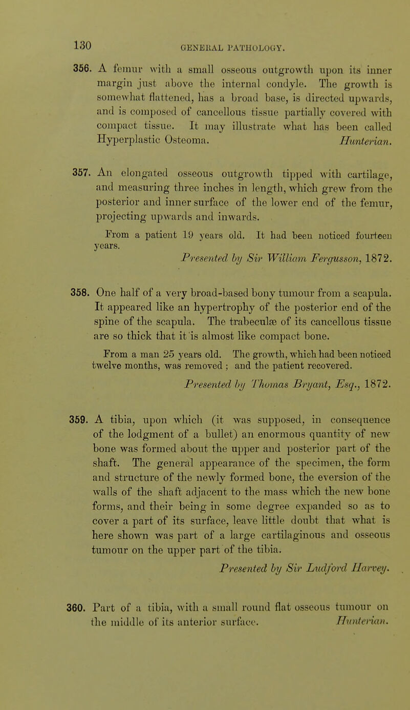 366. A femur with a small osseous outgrowtli upon its iuner margin just nbove the internal condyle. The growth is somewliat fl;itteued, has a broad base, is directed upwards, and is composed of cancellous tissue partially covered with compact tissue. It may illustrate what has been called Hyperplastic Osteoma. Hxmterian. 357. An elongated osseous outgrowth tipped with cartilage, and measuring three inches in length, which grew from the posterior and inner surface of the lower end of the femur, projecting upwards and inwards. From a patient 19 years old. It had been noticed fourteen years. Presented hy Sir William Fergusson, 1872. 358. One half of a very broad-based bony tumour from a scapula. It appeared like an hypertrophy of the posterior end of the spine of the scapula. The trabeculse of its cancellous tissue are so thick that it is almost like compact bone. From a man 25 years old. The growth, which had been noticed twelve months, was removed ; and the patient recovered. Presented hy Thuiims Bryant, Esq., 1872. 359. A tibia, upon which (it was supposed, in consequence of the lodgment of a bullet) an enormous quantity of new bone was formed about the upper and posterior part of the shaft. The general appearance of the specimen, the form and structui'e of the newly formed bone, the eversion of the walls of the shaft adjacent to the mass which the new bone forms, and their being in some degree exj)anded so as to cover a part of its surface, leave little doubt that what is here shown was part of a large cartilaginous and osseous tumour on the upper part of the tibia. Presented hy Sir Lxidford Harvey. 360. Part of a tibia, with a small round flat osseous tumour on the middle of its anterior surface. Hnntevian.