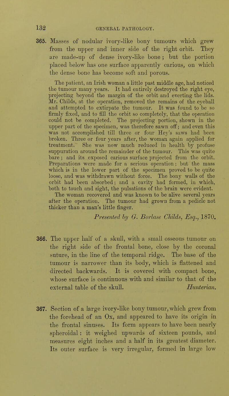 365. Masses of nodular ivory-like bony tumours which grew from the upper and inner side of the right orbit. They are made-up of dense ivory-like bone ; but the portion placed below has one surface apparently carious, on which the dense bone has become soft and porous. The patient, an Irish woman a little past middle age, had noticed the tumour many years. It had entirely destroyed the right eye, projecting beyond the margin of the orbit and everting the lids. Mr. Childs, at the operation, removed the remains of the eyeball and attempted to extirpate the tumour. It was found to be so firmly fixed, and to fill the orbit so completely, that the operation could not be completed. The projecting portion, shown in the upper part of the specimen, was therefore sawn off; and even this was not accomplished till three or four He3-'s saws had been broken. Three or four years after, the woman again applied for treatment. She was now much reduced in health by profuse suppuration around the remainder of the tumour. This was quite bare; and its exposed carious surface projected from the orbit. Preparations were made for a serious operation : but the mass which is in the lower part of the specimen proved to be quite loose, and was withdrawn without force. The bony walls of the orbit had been absorbed; and a cavity had formed, in which, both to touch and sight, the pulsations of the brain were evident. The woman recovered and was known to be alive several years after the operation. The tumour had grown from a pedicle not thicker than a man's little finger. Presented by G. Borlase Childs, Esq., 1870. 366. The upper half of a skull, with a small osseous tumour on the right side of the frontal hone, close by the coronal suture, in the line of the temporal ridge. The base of the tumour is narrower than its body, which is flattened and directed backwards. It is covered with compact bone, whose surface is continuous with and similar to that of the external table of the skull. Hunterian. 367. Section of a large ivory-like bony tumour, which grew from the forehead of an Ox, and appeared to have its origin in the frontal sinuses. Its form appears to have been nearly spheroidal: it weighed upwards of sixteen pounds, and measures eight inches and a half in its greatest diameter. Its outer surface is very irregular, formed in large low