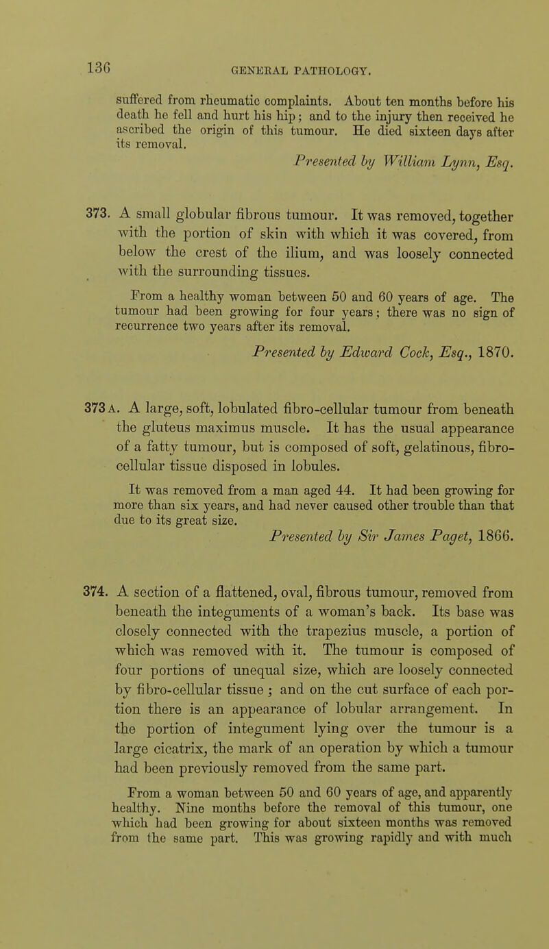 13G suffered from rheumatic complaints. About ten months before his death ho fell and hurt his hip; and to the injury then received he ascribed the origin of this tumour. He died sixteen days after its removal. Presented hy William Lynn, Esq. 373. A siiiiill globular fibrous tumour. It was removed, together with the portion of skin with which it was covered, from below the crest of the ilium, and was loosely connected with the surrounding tissues. From a healthy woman between 50 and 60 years of age. The tumour had been growing for four years; there was no sign of recurrence two years after its removal. Presented hy Edward Cocky Esq., 1870. 373 a. a large, soft, lobulated fibro-cellular tumour from beneath the gluteus maximus muscle. It has the usual appearance of a fatty tumour, but is composed of soft, gelatinous, fibro- cellular tissue disposed in lobules. It was removed from a man aged 44. It had been growing for more than six years, and had never caused other trouble than that due to its great size. Presented hy Sir James Paget, 1866. 374. A section of a flattened, oval, fibrous tumour, removed from beneath the integuments of a woman's back. Its base was closely connected with the trapezius muscle, a portion of which was removed vrith it. The tumour is composed of four portions of unequal size, which are loosely connected by fibro-cellular tissue ; and on the cut surface of each por- tion there is an appearance of lobular arrangement. In the portion of integument lying over the tumour is a large cicatrix, the mark of an operation by which a tumour had been previously removed from the same part. From a woman between 50 and 60 years of age, and ajjparently healthy. Nine months before the removal of this tumour, one which had been growing for about sixteen months was removed from the same part. This was growing rapidly and with much