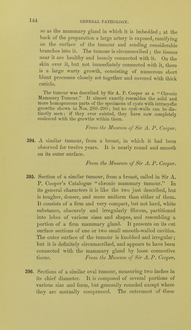 SO as the mammary gland in Avhicli it is imbedded ; at the back of the jDreiJaration a large artery is exposed, ramifying on the surface of the tumonr and sending considerable branches into it. The tumour is circumscribed ; the tissues near it are healthy and loosely connected with it. On the skin over it, but not immediately connected with it, there is a large warty growth, consisting of numerous short blunt processes closely set together and covered with thick cuticle. The tumour was described by Sir A. P. Cooper as a  Chronic Mammary Tumour. It almost exactly resembles the solid and more homogeneous parts of the specimens of cysts with intracystic growths shown in Nos. 280-290; but no cyst-walls can be dis- tinctly seen; if they ever existed, they have now completely coalesced with the growths within them. From the Museum of Sir A. P. Cooper. 394. A similar tumour, from a breast, in which it had been observed for twelve years. It is nearly round and smooth on its outer surface. From the Muse^wl of Sir A. P. Cooper. 395. Section of a similar tumour, from a breast, called in Sir A. P. Cooper's Catalogue  chronic mammary tumour. In its general characters it is like the two just described, but is tougher, denser, and more uniform than either of them. It consists of a firm and very compact, but not hard, white substance, obscurely and irregularly fibrous, partitioned into lobes of various sizes and shapes, and resembling a portion of a firm mammary gland. It presents on its cut surface sections of one or two small smooth-walled cavities. The outer surface of the tumour is knobbed and irregular; but it is definitely circumscribed, and appears to have been connected with the mammary gland by loose connective tissue. From the Museum of Sir A. P. Cooper. 396. Sections of a similar oval tumour, measuring two inches in its chief diameter. It is com])osed of several portions of various size and form, but generally rounded except where they are mutually compressed. The outermost of these