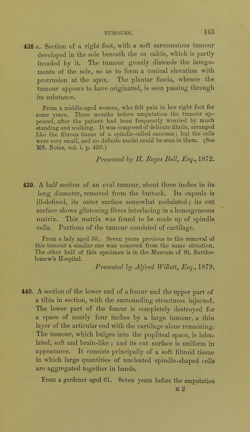 438 A. Section of a right foot, with a soft sarcomatous tumour developed in the sole beneath the os calcis, which is partly- invaded by it. The tumour greatly distends the integu- ments of the sole, so as to form a conical elevation with protrusion at the apex. The plantar fascia, whence the tumour appears to have originated, is seen passing through its substance. From a middle-aged woman, who felt pain in her right foot for some years. Three months before amputation the tnmour ap- peared, after the patient had been frequentlj-- wearied by much standing and walking. It was composed of delicate fibrils, arranged like the fibrous tissue of a spindle-ceUed sarcoma; but the cells were very small, and no definite nuclei could be seen in them. (See MS. Notes, vol. i. p. 459.) Presented hy H. Royes Bell, Esq., 1872. 439. A half section of an oval tumour, about three inches in its long diameter, removed from the buttock. Its capsule is ill-defined, its outer surface somewhat nodulated; its cut surface shows glistening fibres interlacing in a homogeneous matrix. This matrix was found to be made up of spindle cells. Portions of the tumour consisted of cartilage. From a lady aged 58. Seven years previous to the removal of this tumour a similar one was removed from the same situation. The other half of this specimen is in the Museum of St. Bartho- lomew's Hospital. Presented hy Alfred Willett, Esq., 1879. 440. A section of the lower end of a femur and the upper part of a tibia in section, with the surrounding structures injected. The lower part of the femur is completely destroyed for a space of nearly four inches by a large tumour, a thin layer of the articular end with the cartilage alone remaining. The tumour, which bulges into the popliteal space, is lobu- lated, soft and brain-like ; and its cut surface is uniform in appearance. It consists principally of a soft fibroid tissue in which large quantities of nucleated spindle-shaped cells are aggregated together in bands. From a gardener aged 61. Seven years before the amputation m2